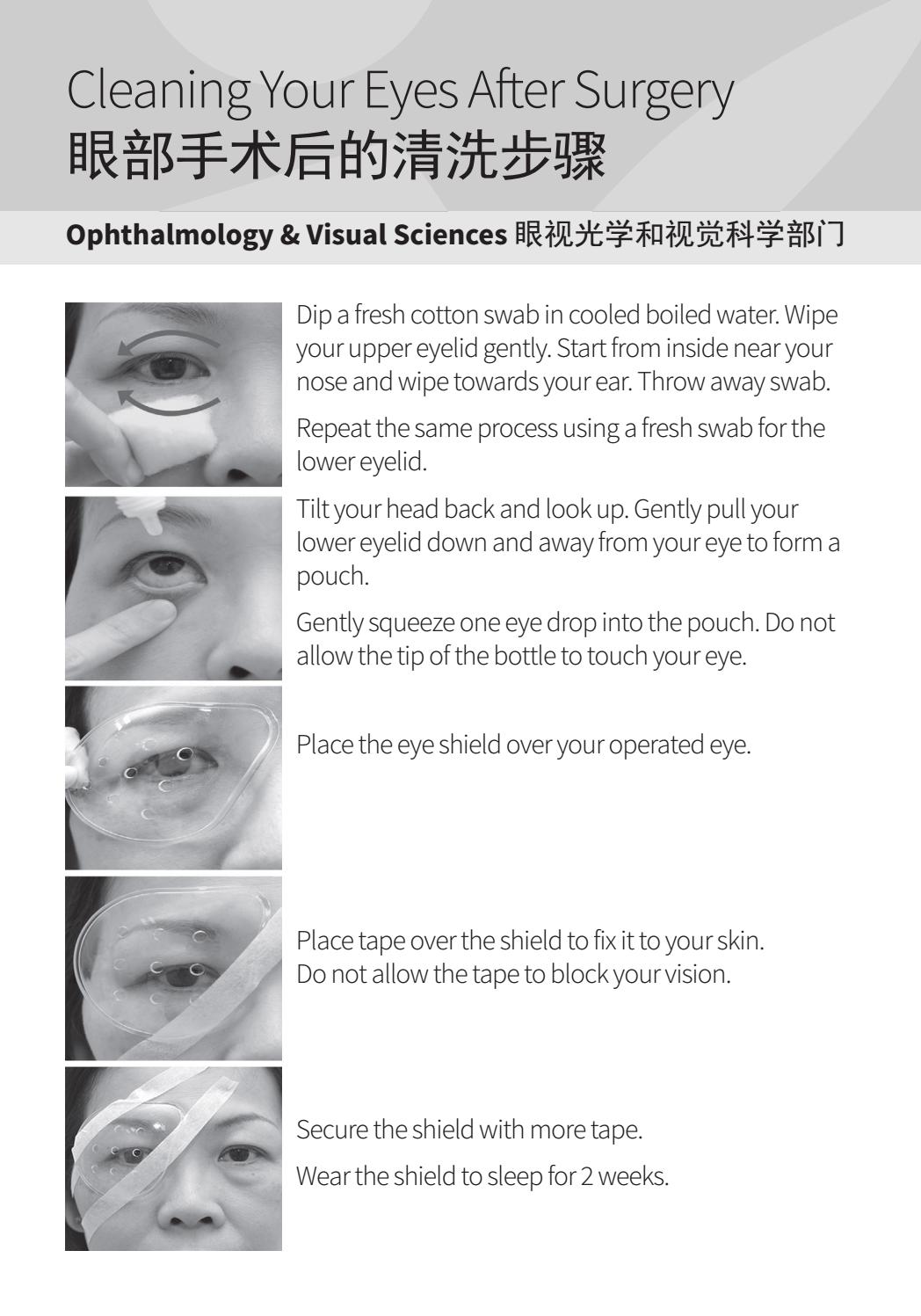 Cleaning Your Eyes After Surgery by Yishun Health Issuu