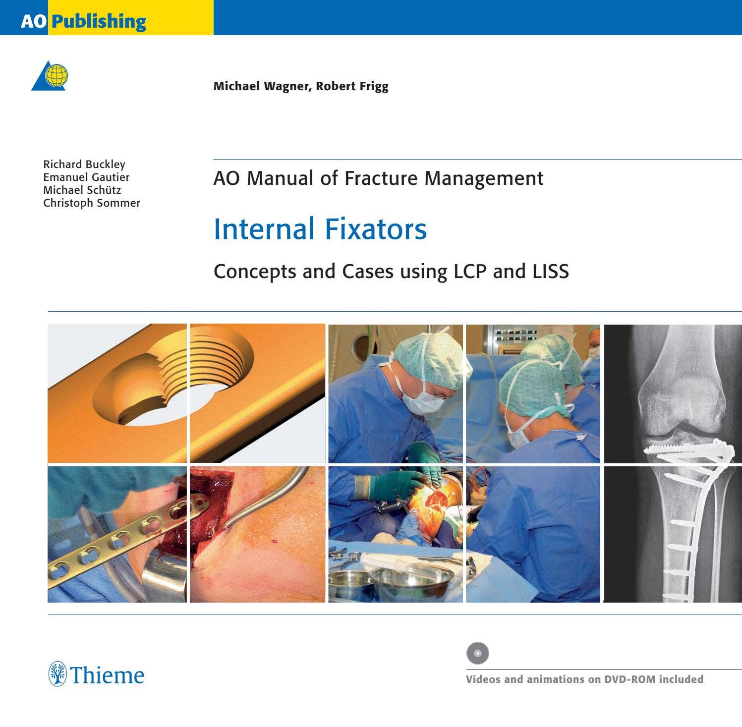 AO法骨折治療internal fixators : LCPとLISSによる内… AO法骨折治療Internal Fixators[英語版DVD-ROM付] LCPとLISS