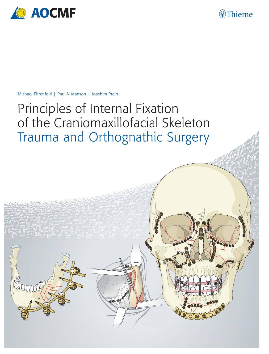 AO法 骨折治療 Internal Fixators AO法骨折治療 Internal Fixators [英語版DVD-ROM付] | 書籍詳細
