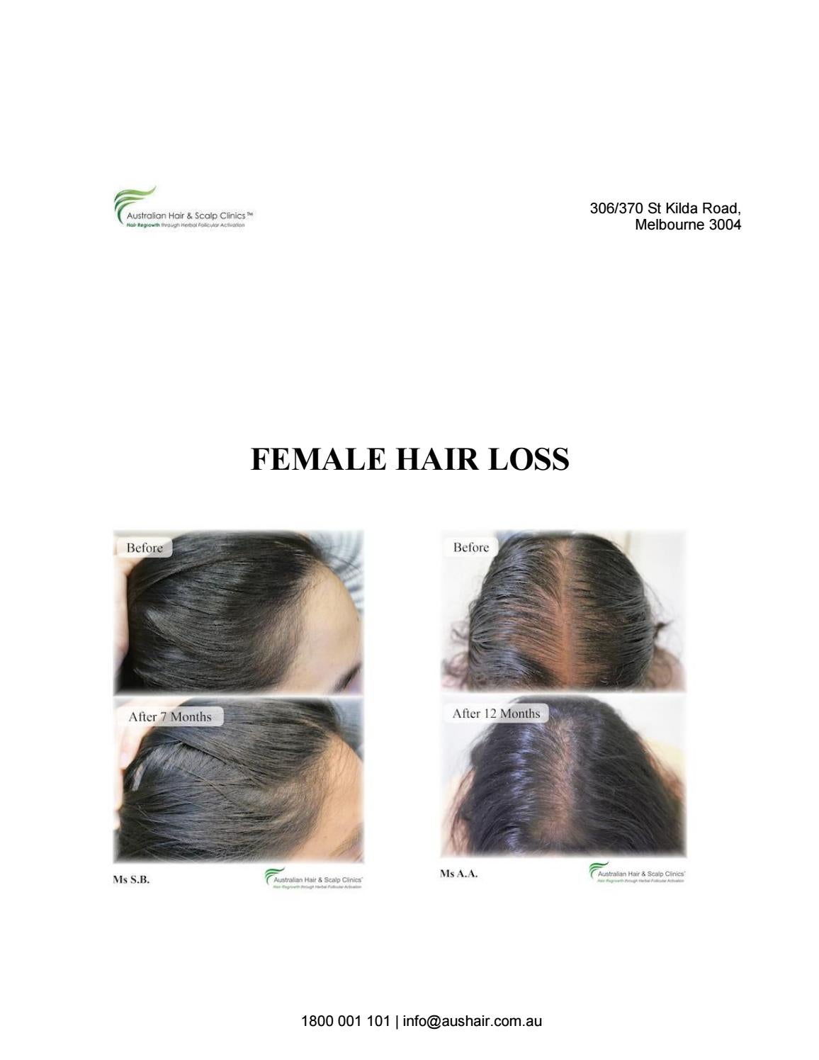 Female Hair Loss Treatment by Australian Hair & Scalp Clinic Issuu