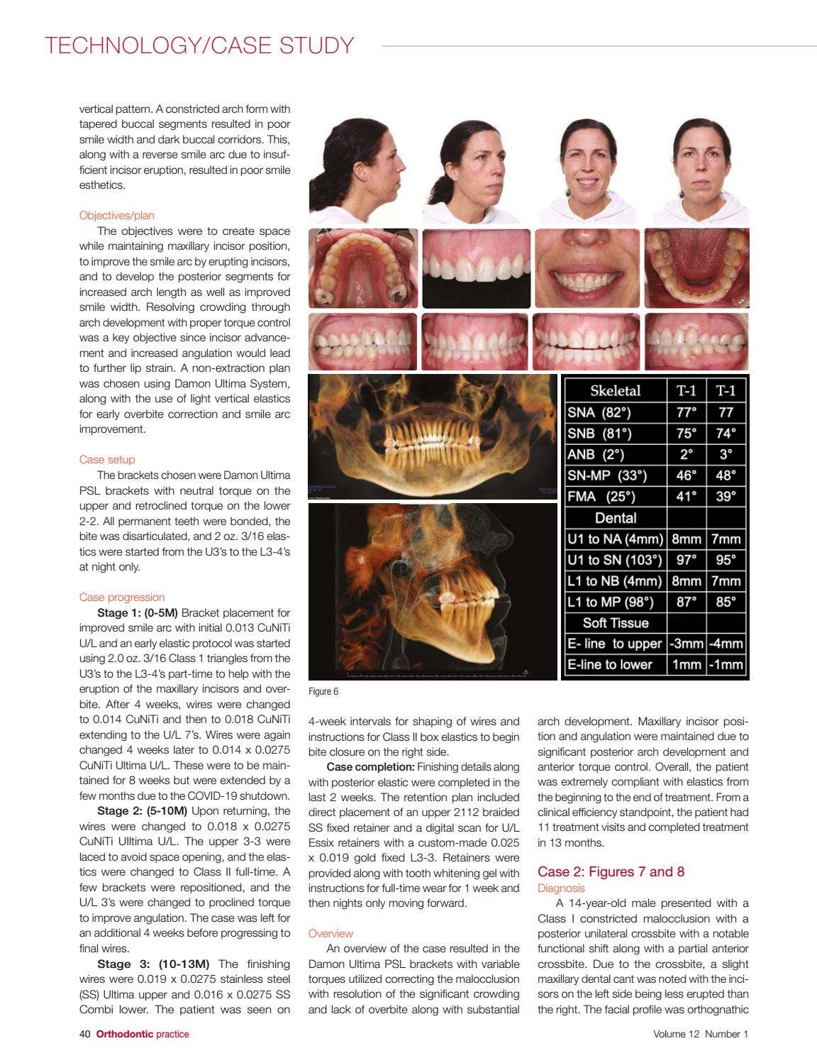 Orthodontic Practice US Spring 2021 Vol 12 No 1 by MedMark, LLC - Issuu