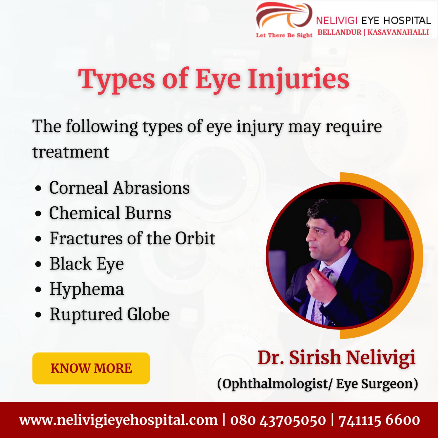 Types of Eye Injuries Best Eye Hospitals in Bellandur, Bangalore