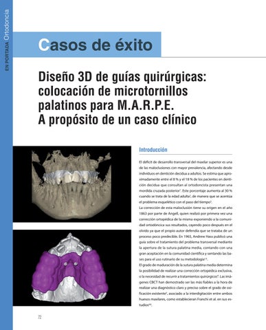 Page 72