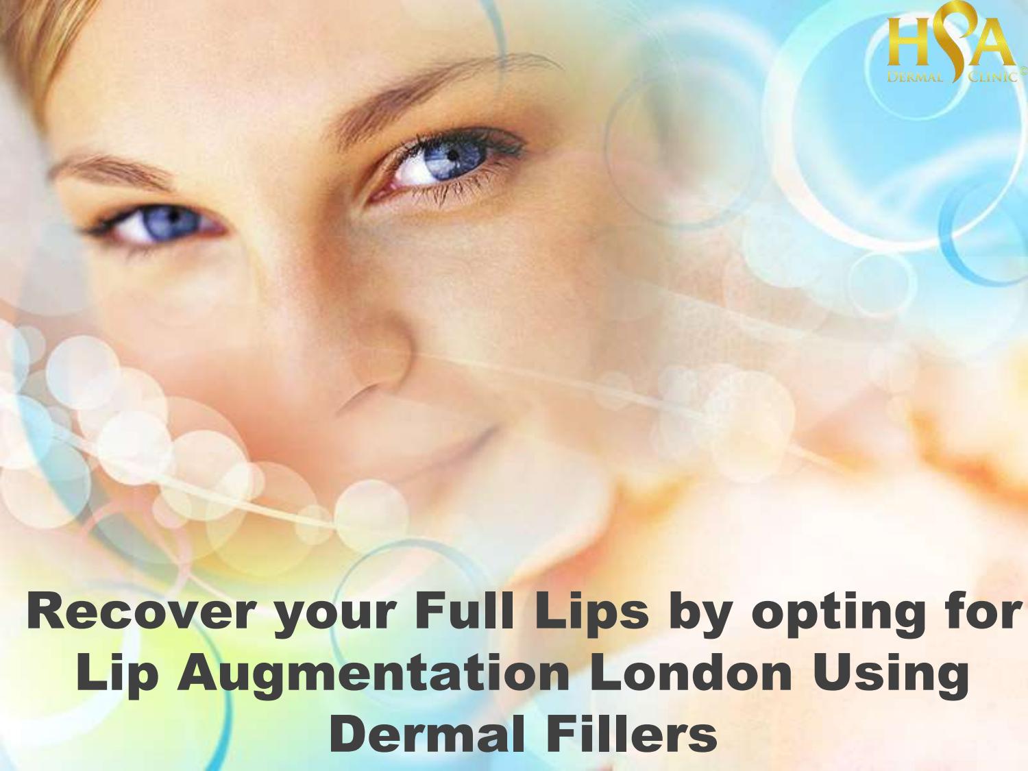 Recover your Full Lips by opting for Lip Augmentation London Using