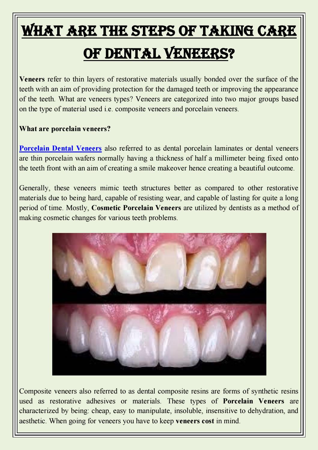 What are the steps of taking care of Dental Veneers? by Edge Dental Issuu