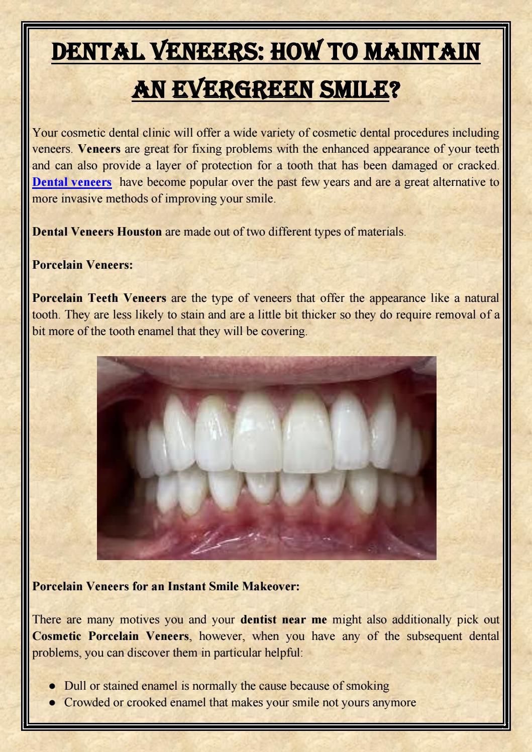 Dental Veneers How To Maintain An Evergreen Smile? by Edge Dental Issuu