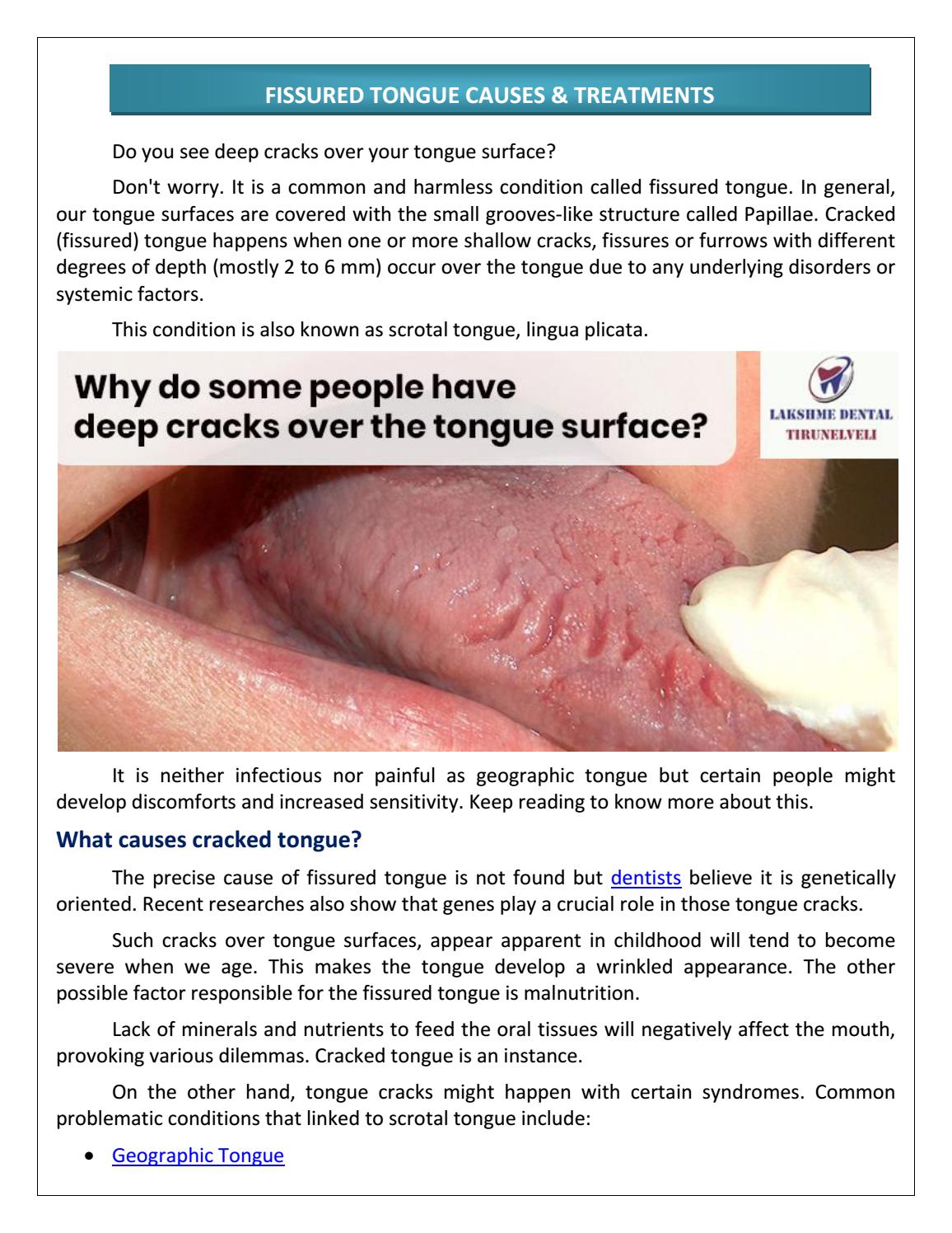 Fissured Tongue and Treatments by vertikapargat - Issuu