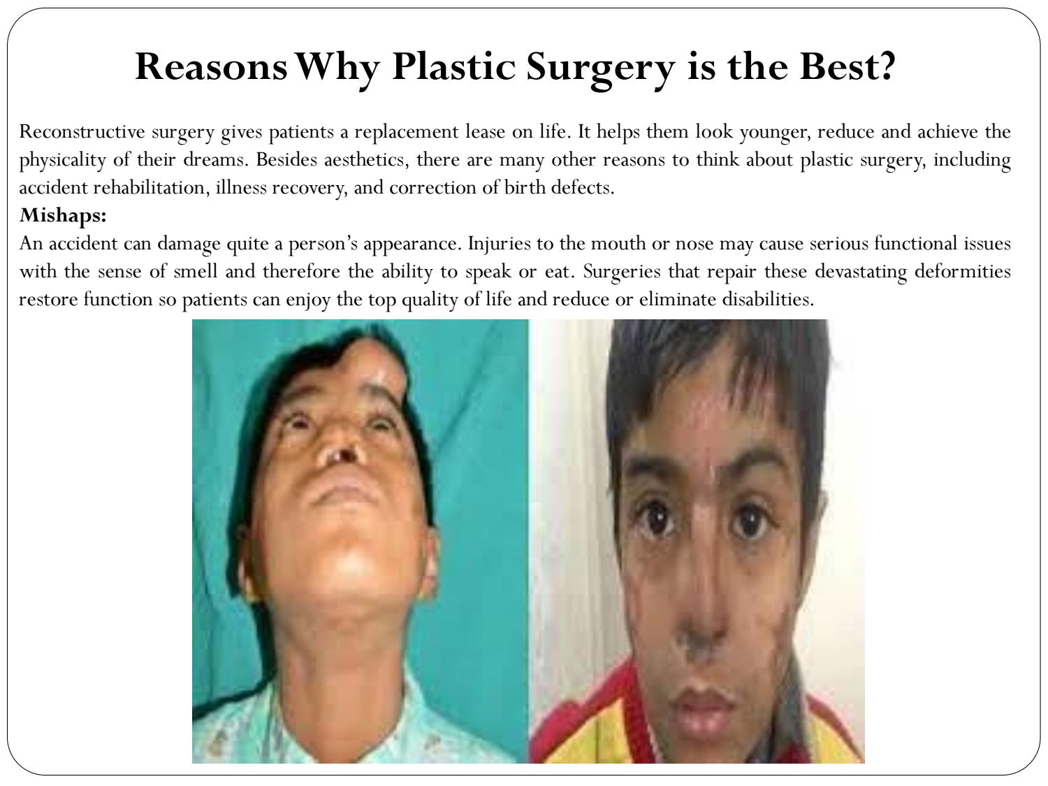 Reasons Why Plastic Surgery is the Best Dr Ashwini Dash Life