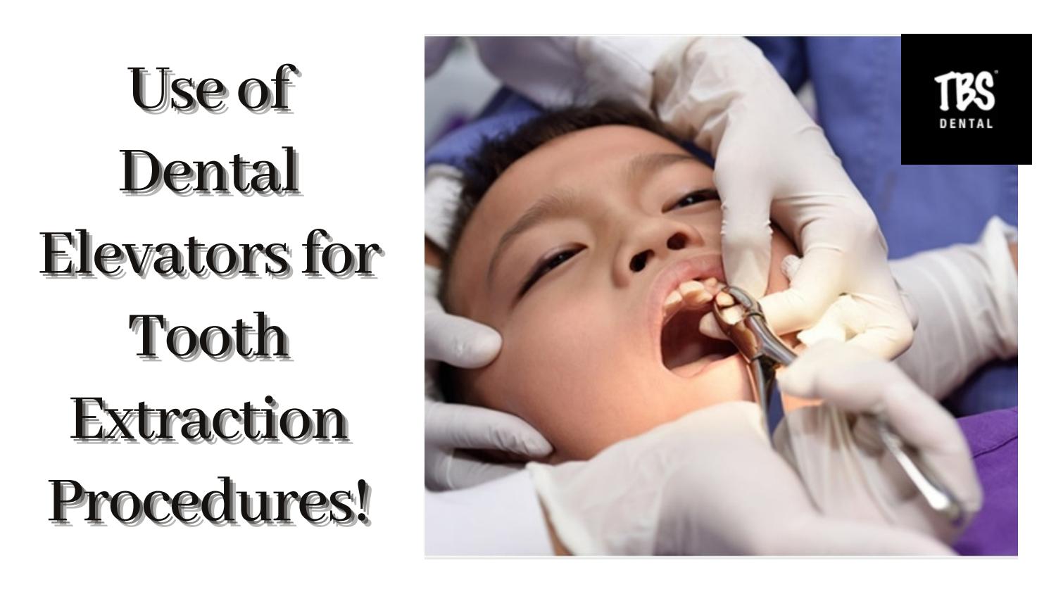 Use of Dental Elevators For Tooth Extraction Procedure by TBS Dental