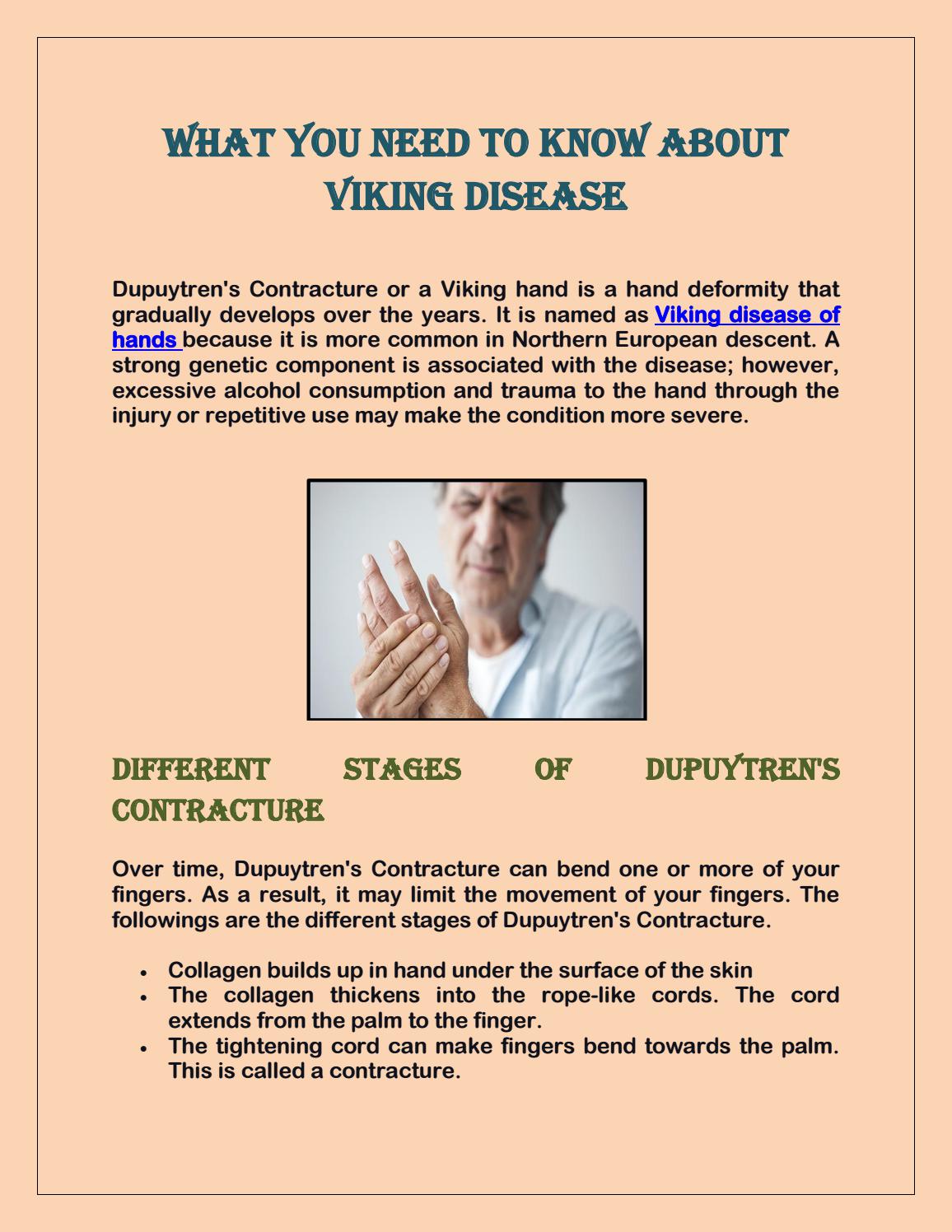 What You Need to Know About Viking Disease by dupuytrenswand Issuu