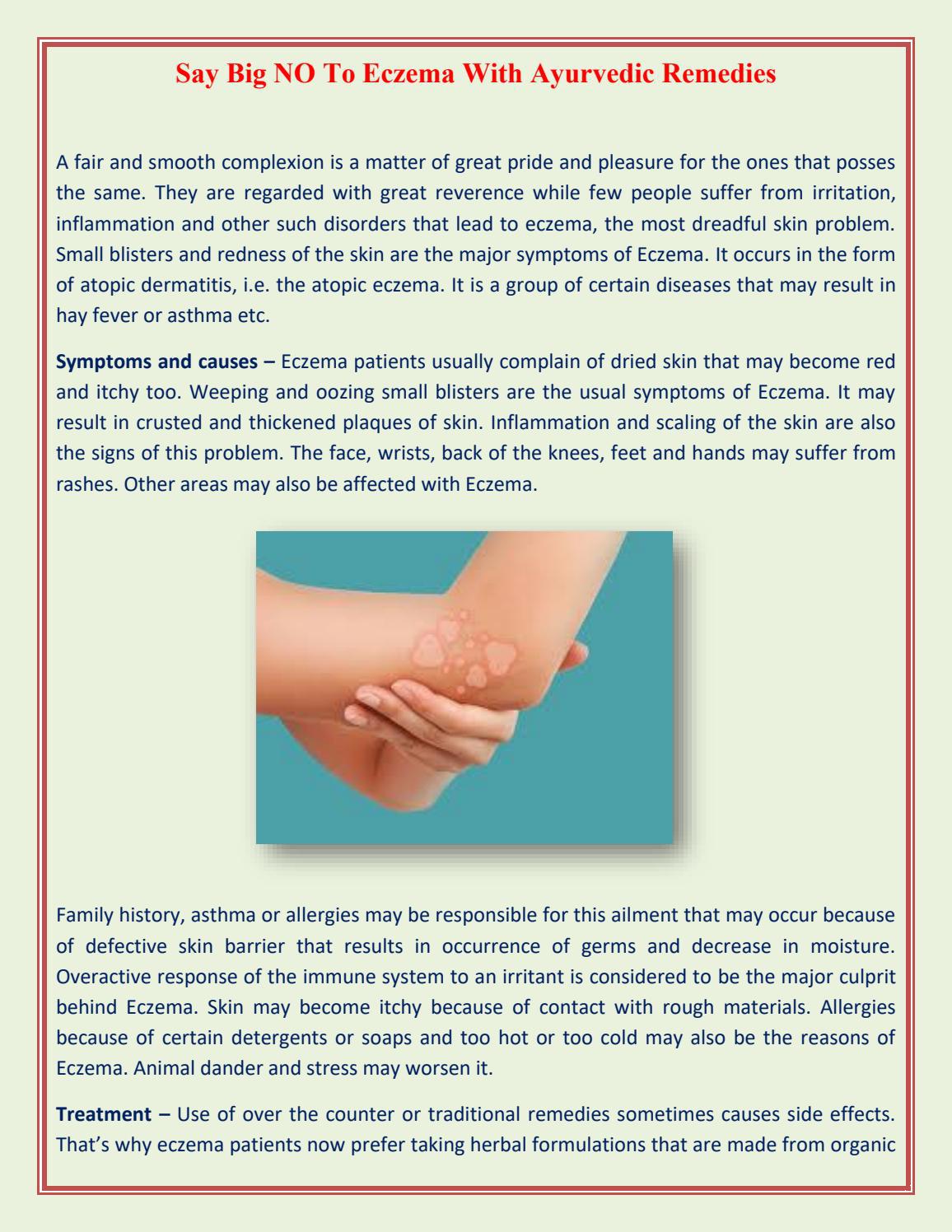 Say Big NO to Eczema With Ayurvedic Remedies by Ramdev Medicine Issuu