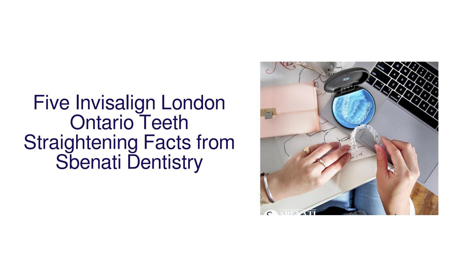 Five Invisalign London Ontario Teeth Straightening Facts from Sbenati