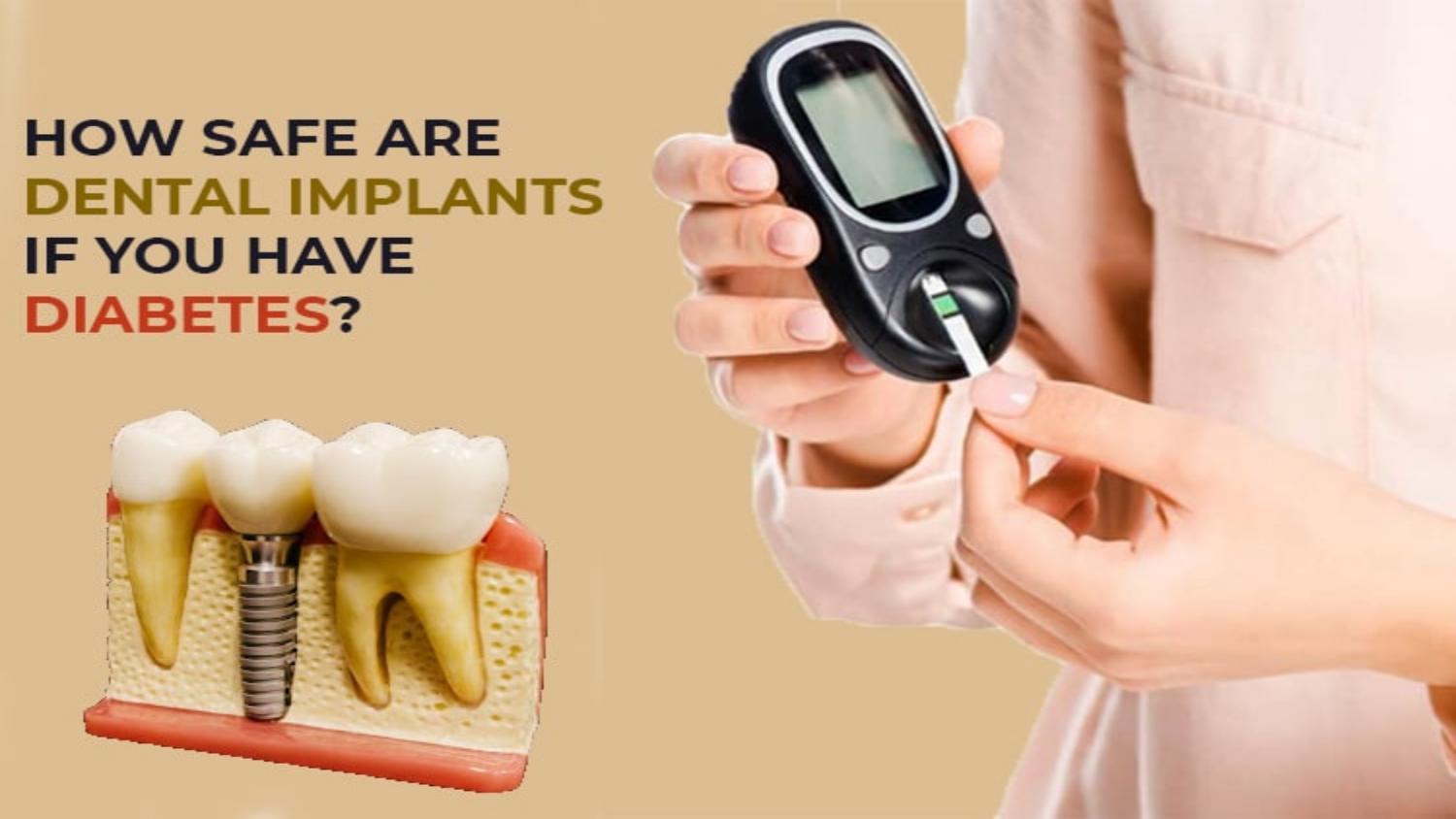 How Safe Are Dental Implants If You Have Diabetes? by world dentistry