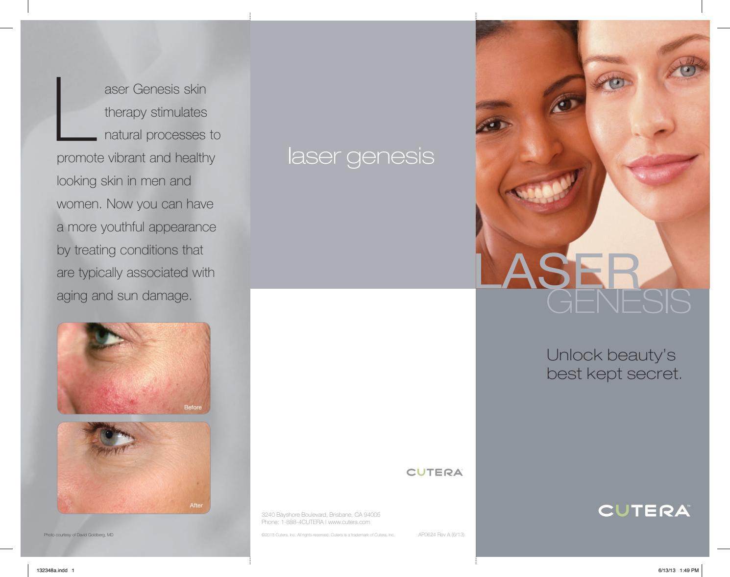 Laser Genesis (excel V and xeo) Patient Pamphlet by Cutera Issuu