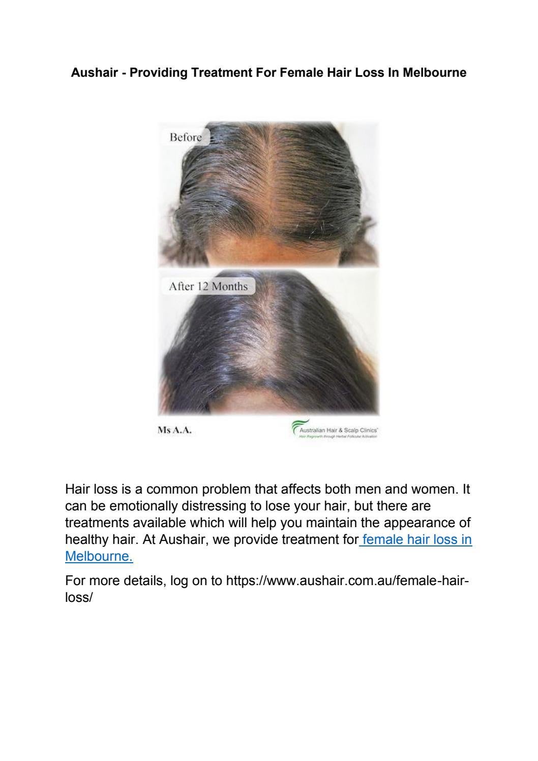 Aushair Providing Treatment For Female Hair Loss In Melbourne by