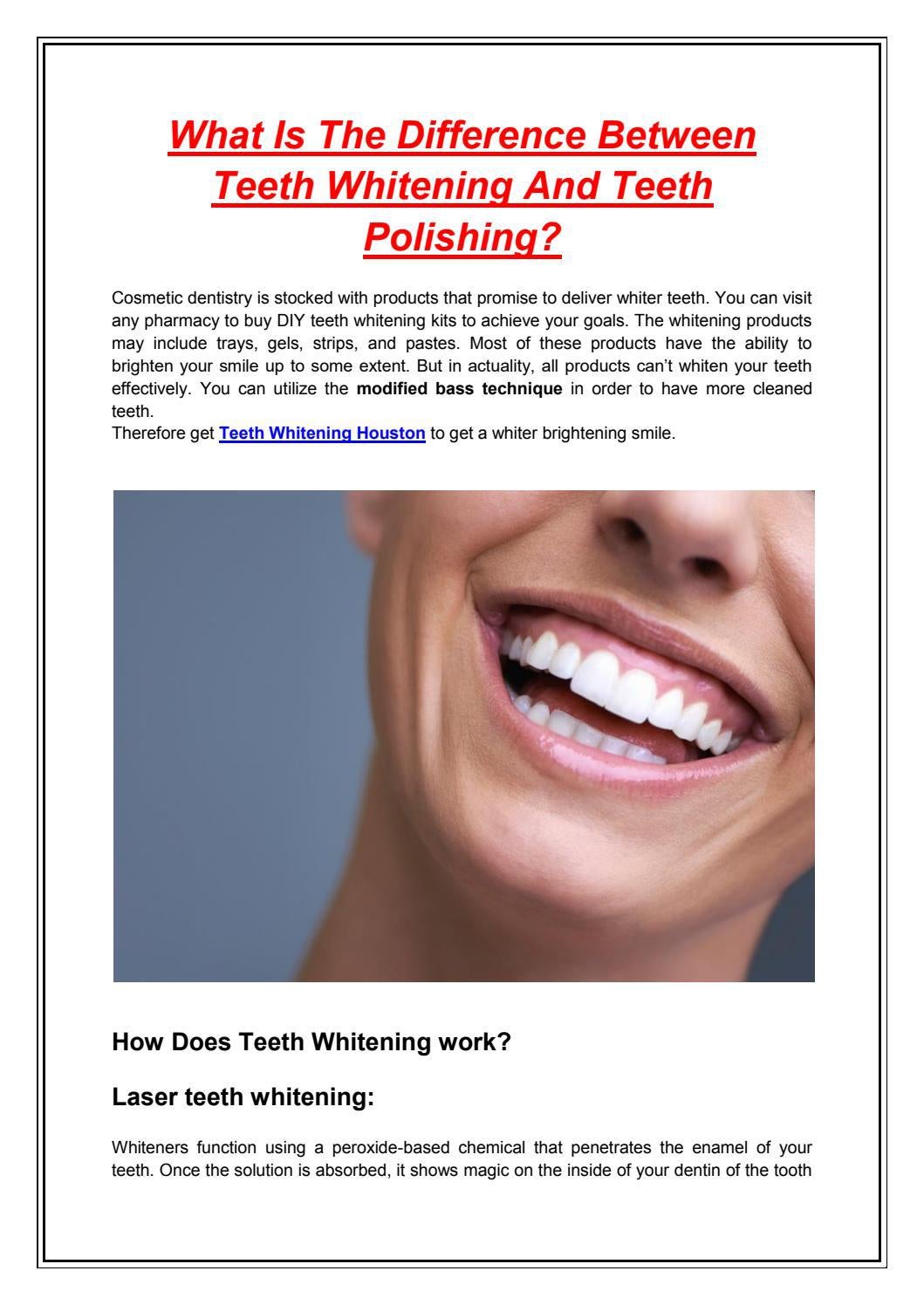 What Is The Difference Between Teeth Whitening And Teeth Polishing? by