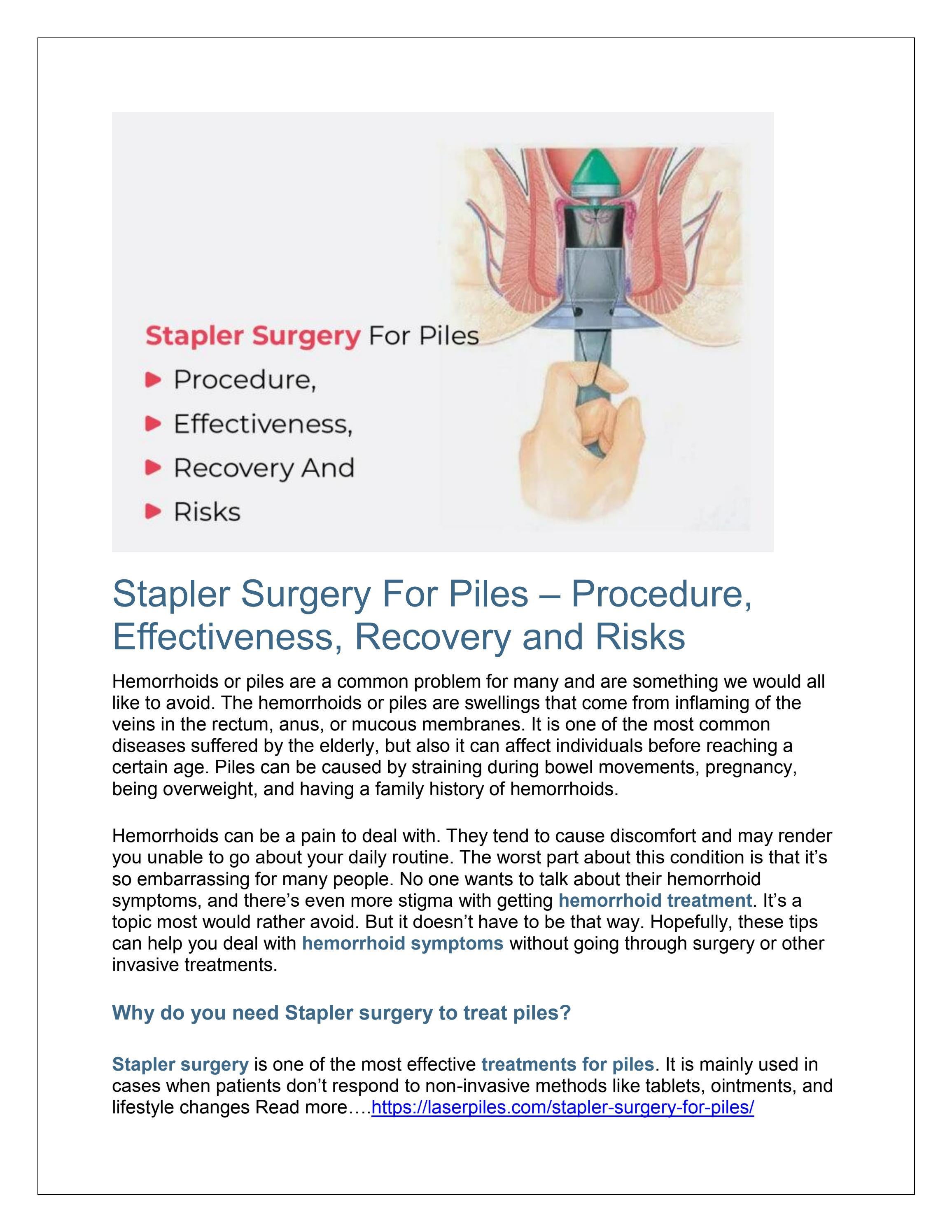 Stapler Surgery For Piles In Hindi at Helen Soria blog