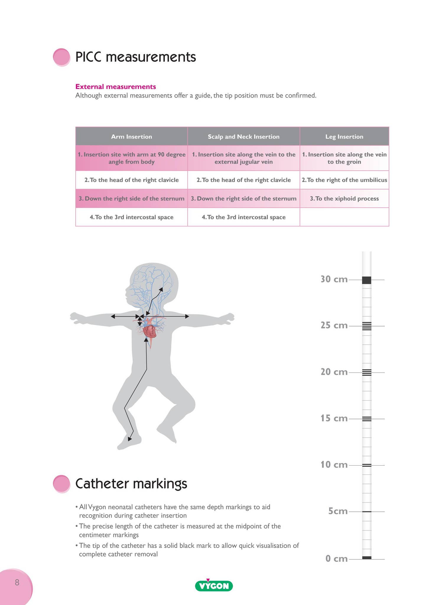 Neonatal PICC Resources by VygonGroup - Issuu