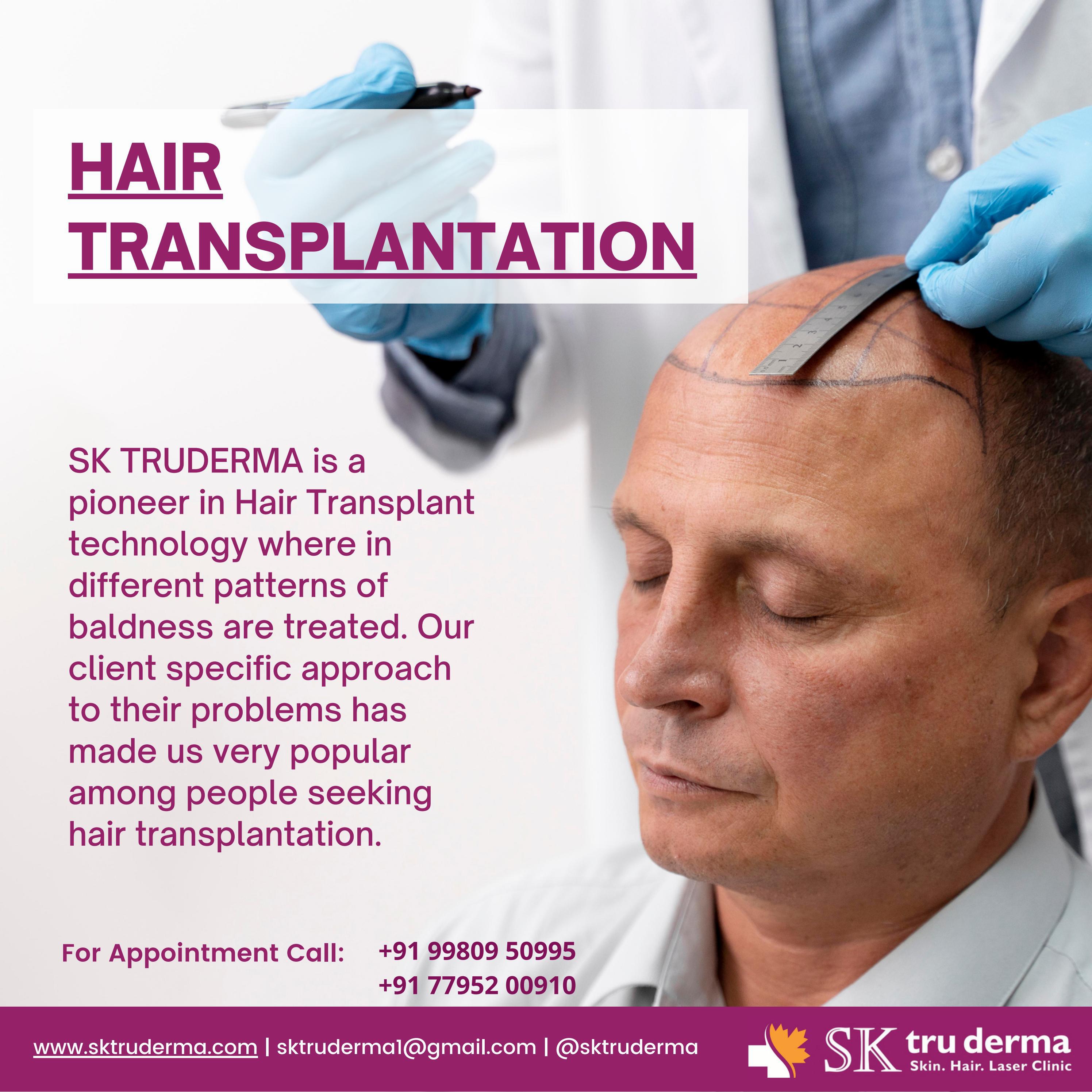 Hair Transplantation by Best Dermatologist in Sarjapur Road, Dr