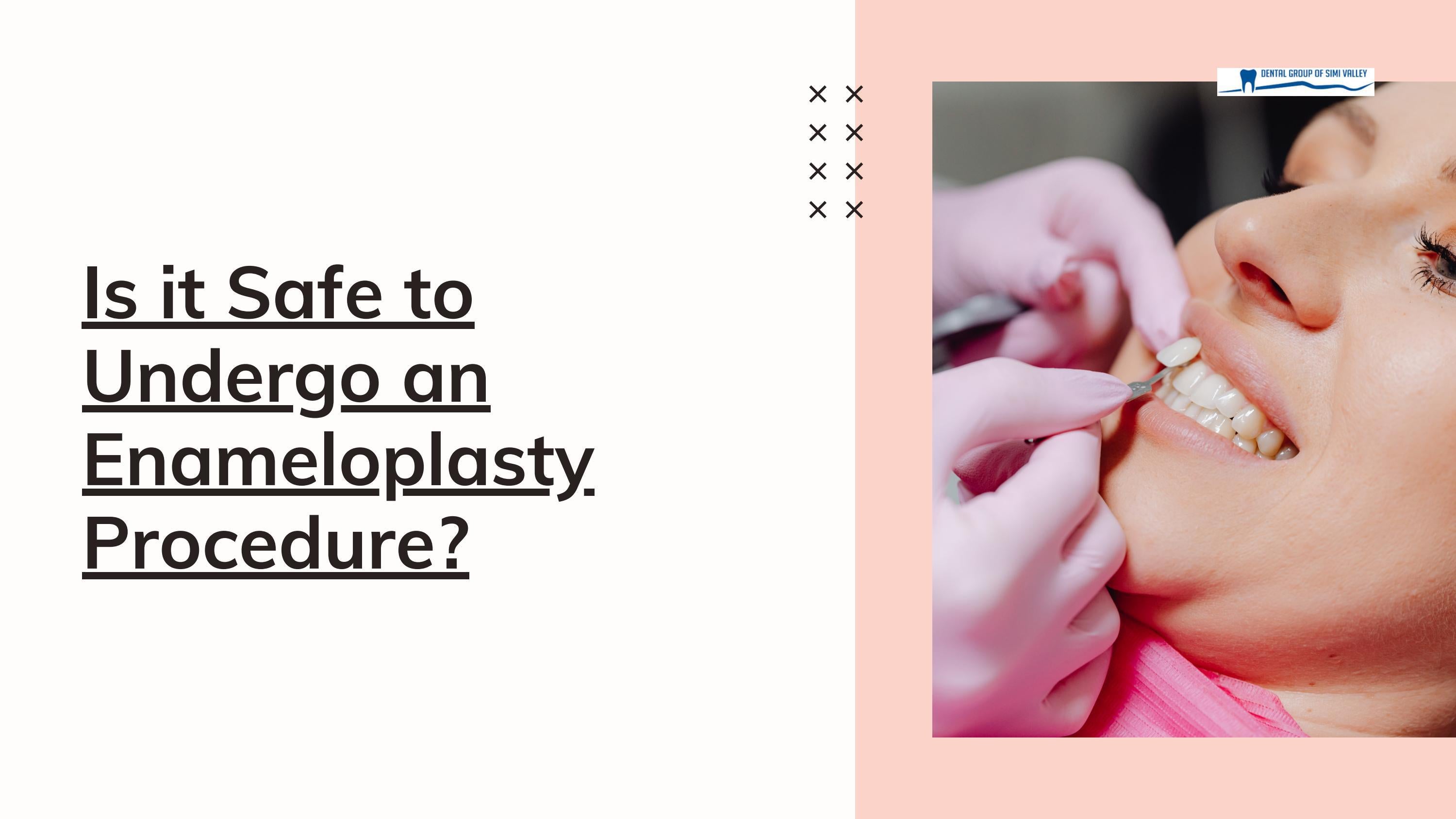 Is it Safe to Undergo an Enameloplasty Procedure? by Dental Group of