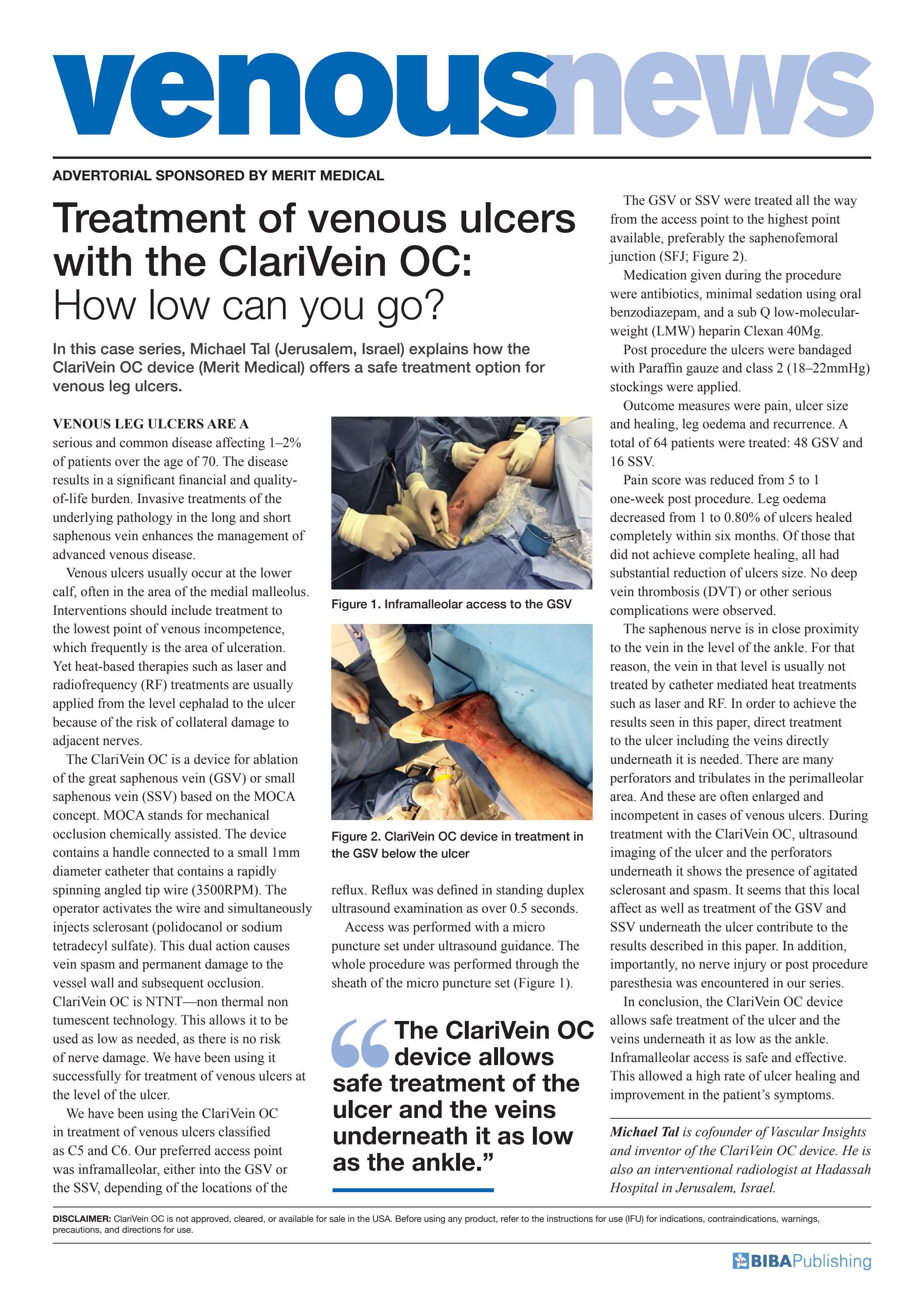 Venous News Merit Medical advertorial May 2022 by BIBA Publishing Issuu