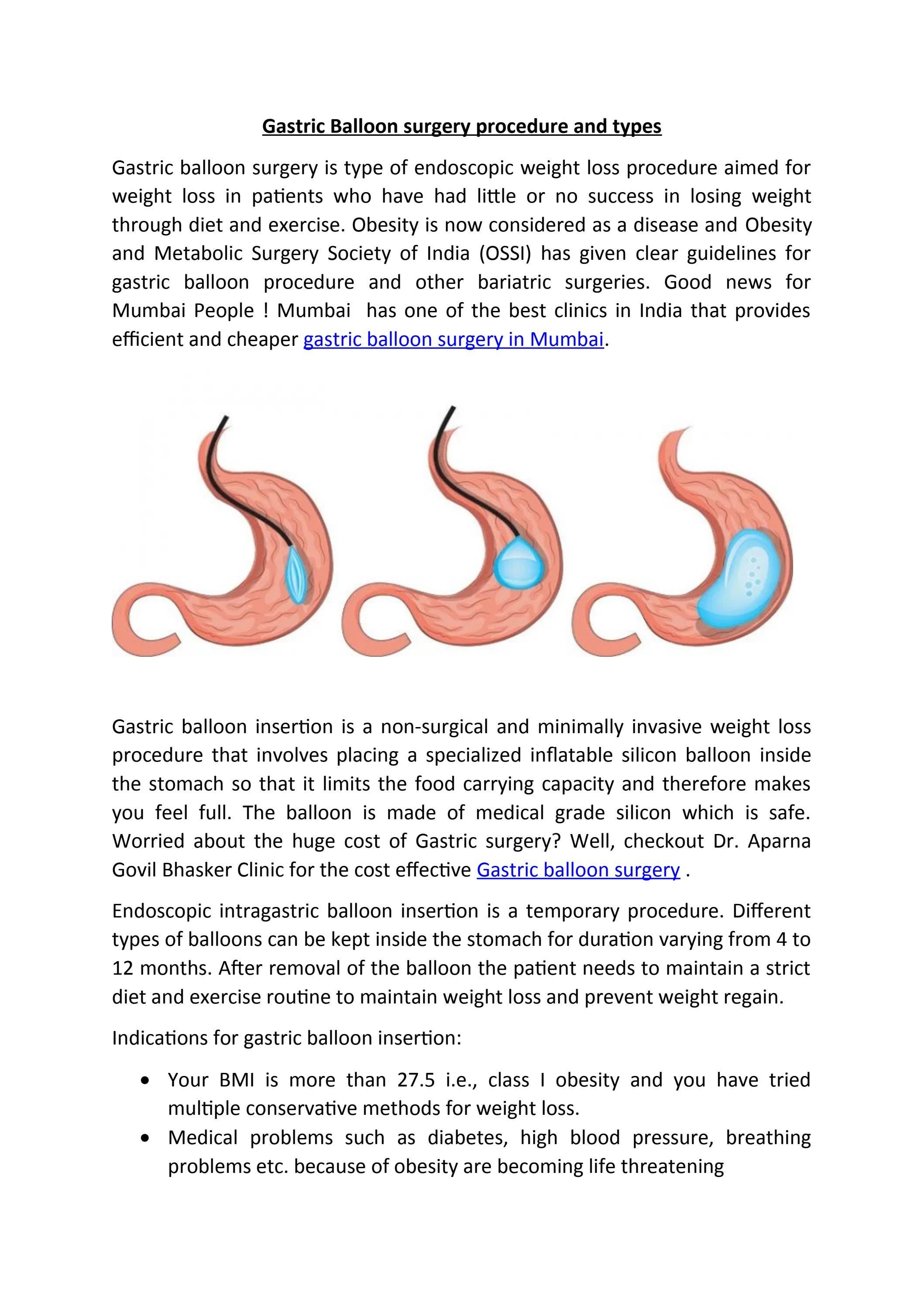 Gastric Balloon surgery procedure and Types by Hazel Beach Issuu
