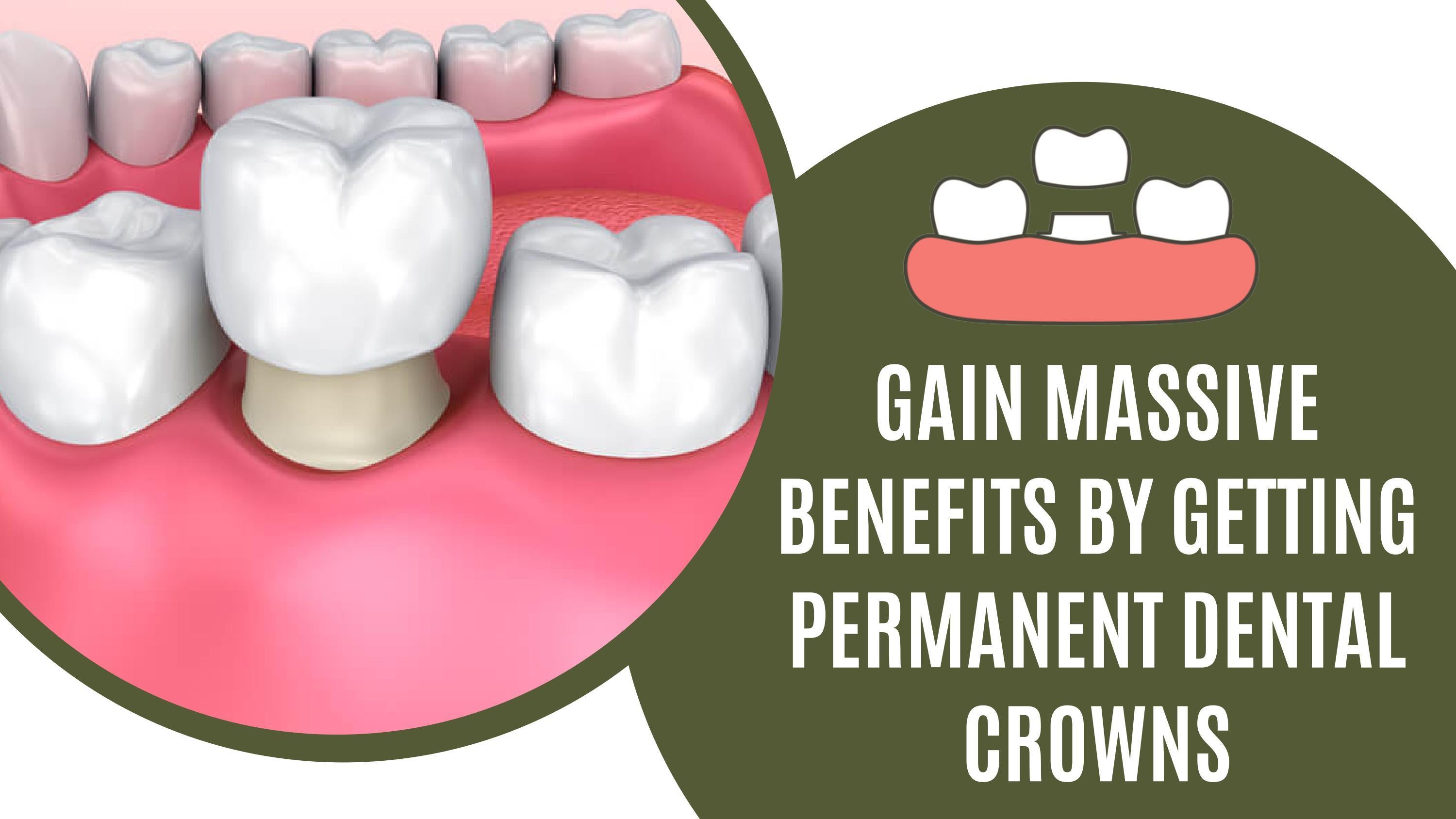 Permanent Dental Crowns For Teeth Preservation by Ashwood Dental Issuu