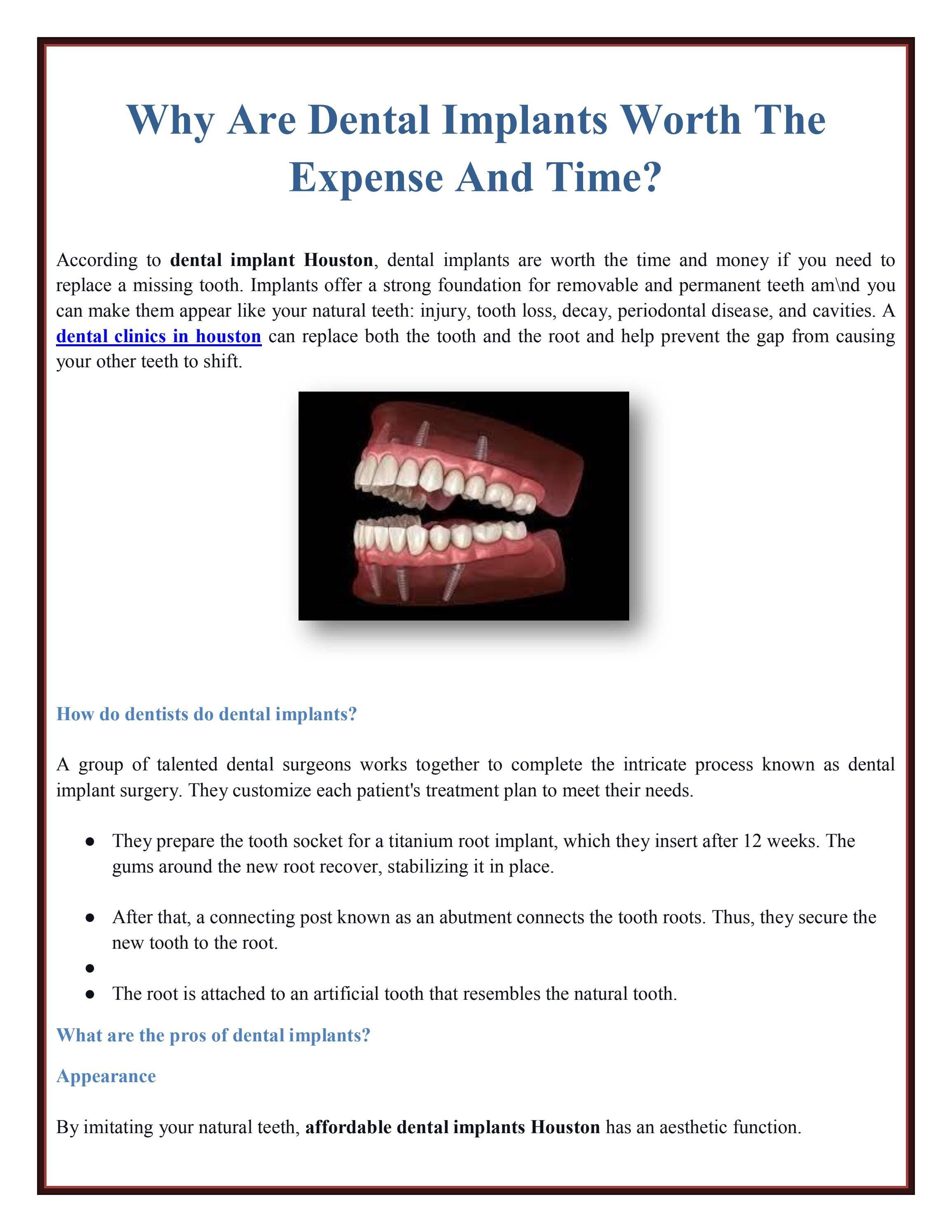 Why Are Dental Implants Worth The Expense And Time? by Laticia Gibson