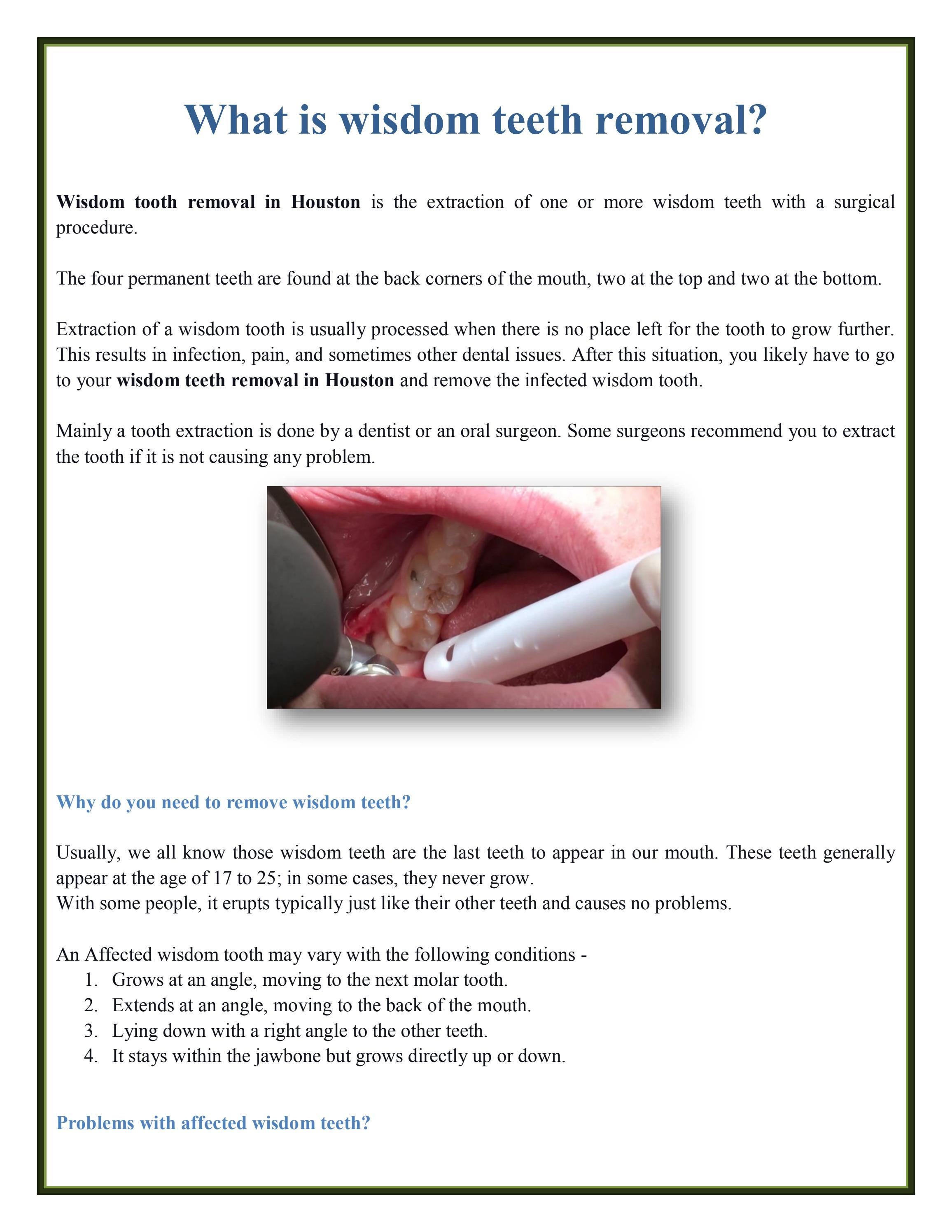 What is wisdom teeth removal? by Laticia Gibson Issuu