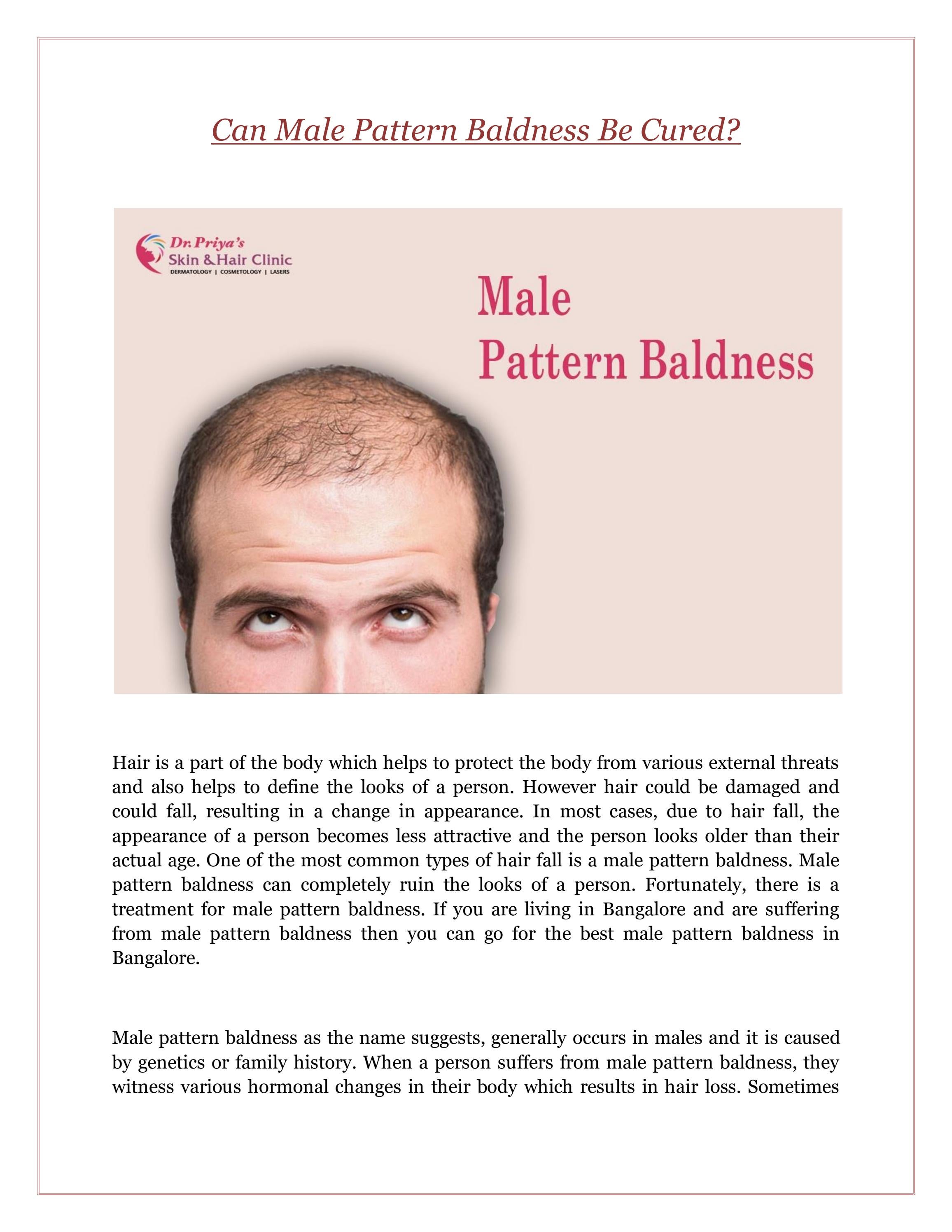 Can Male Pattern Baldness Be Cured? by Dr Priya Skin And Hair Clinic