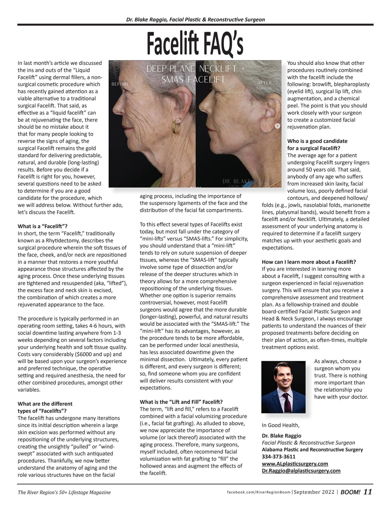 Dr Raggio Facelift FAQ’s-Dr. Raggio-BOOM! September 2022 by Boomer Communities ...