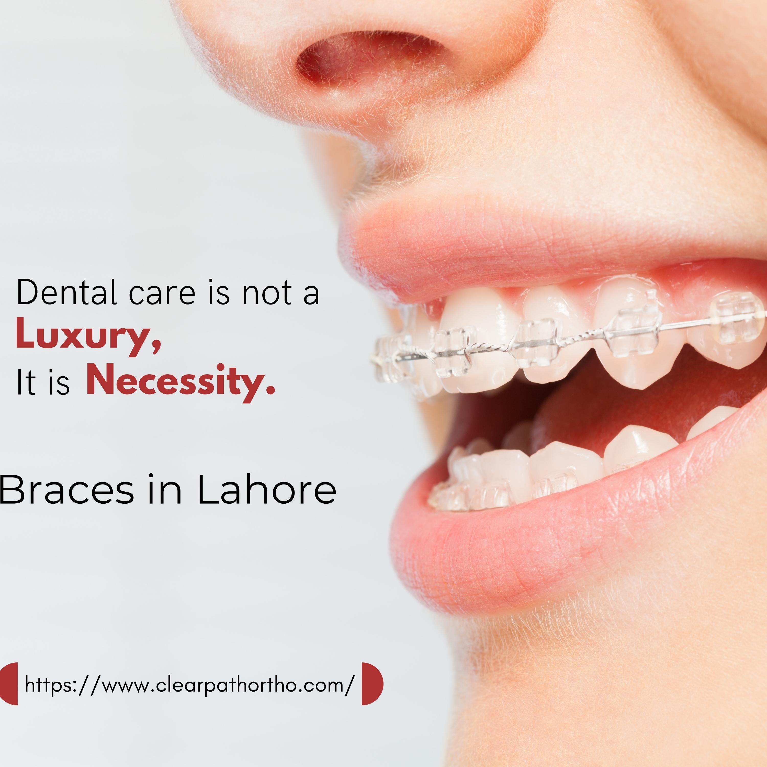 Braces in Lahore by ClearPath Orthodontics Issuu