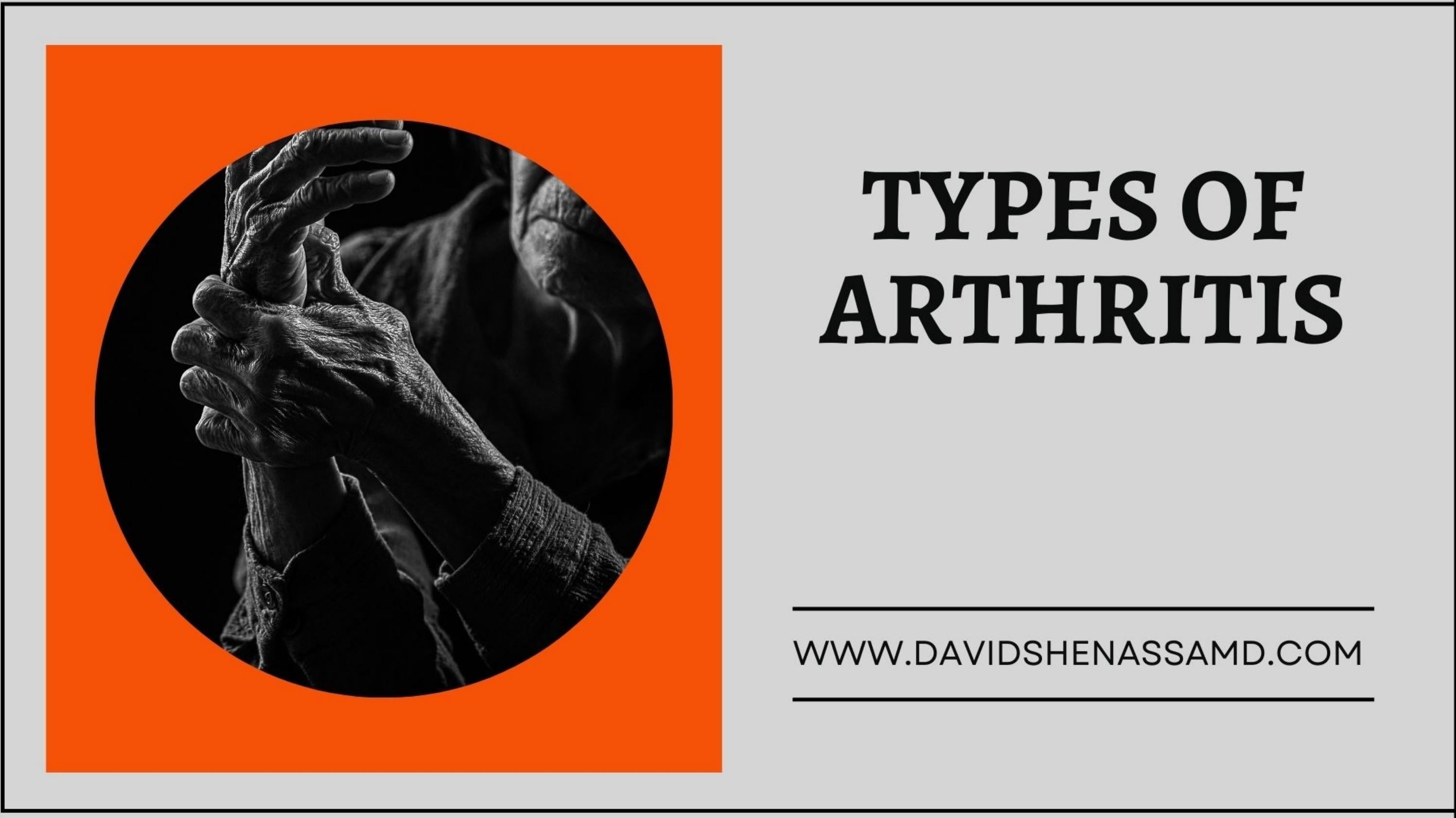 Types of Arthritis by Dr. David Shenassa, MD Issuu