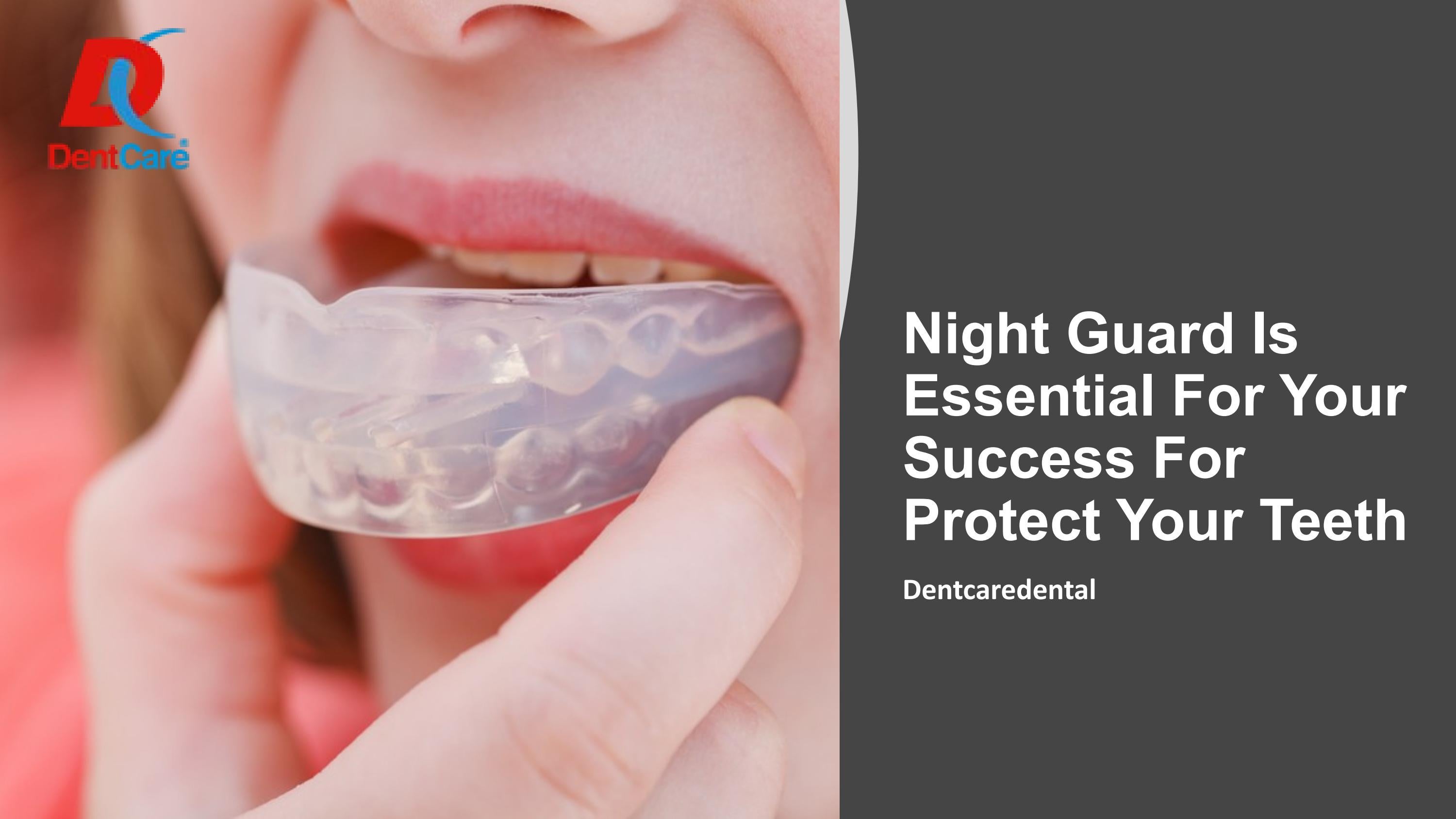 Night Guard Is Essential For Your Success For Protect Your Teeth by