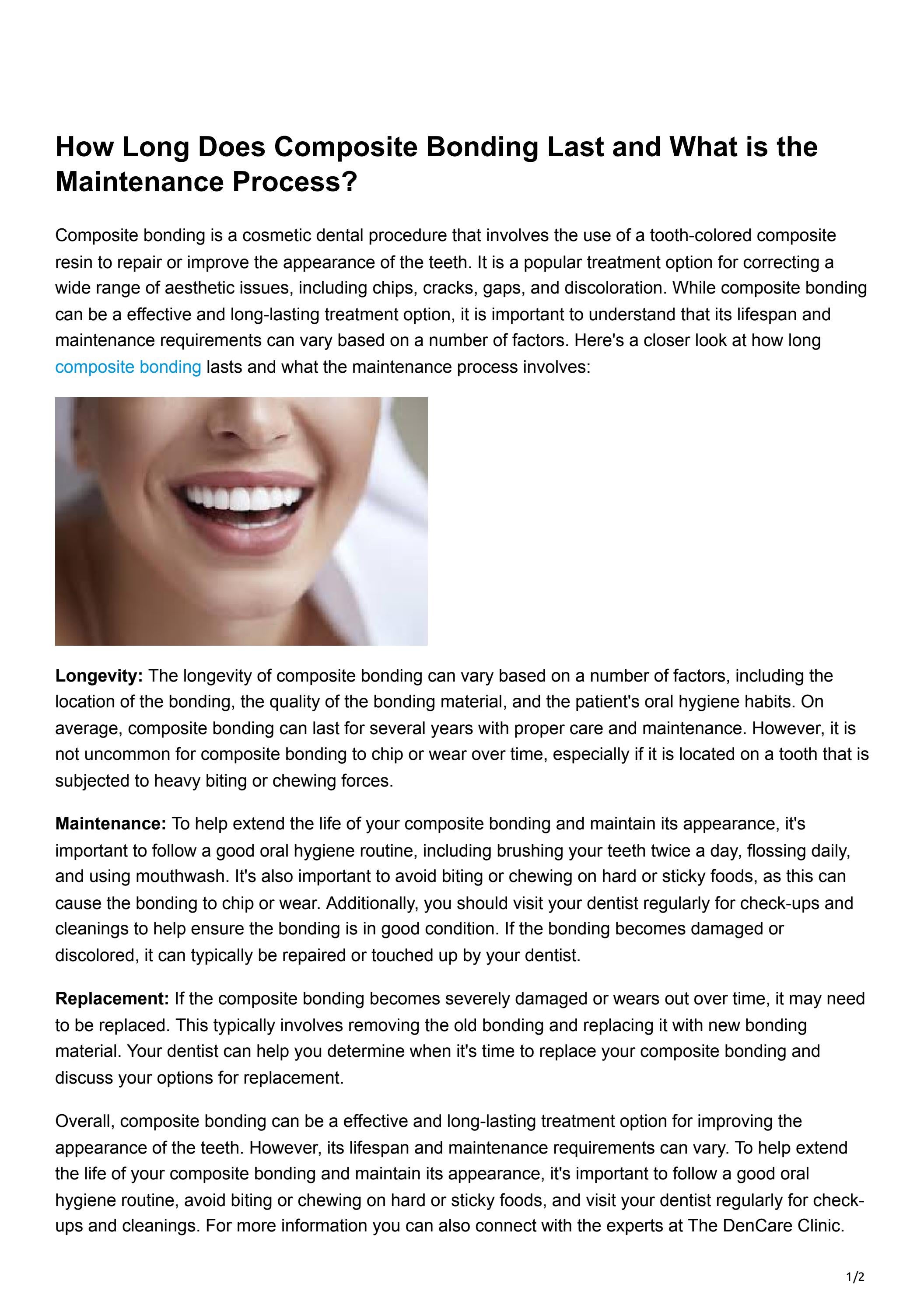 How Long Does Composite Bonding Last and What is the Maintenance