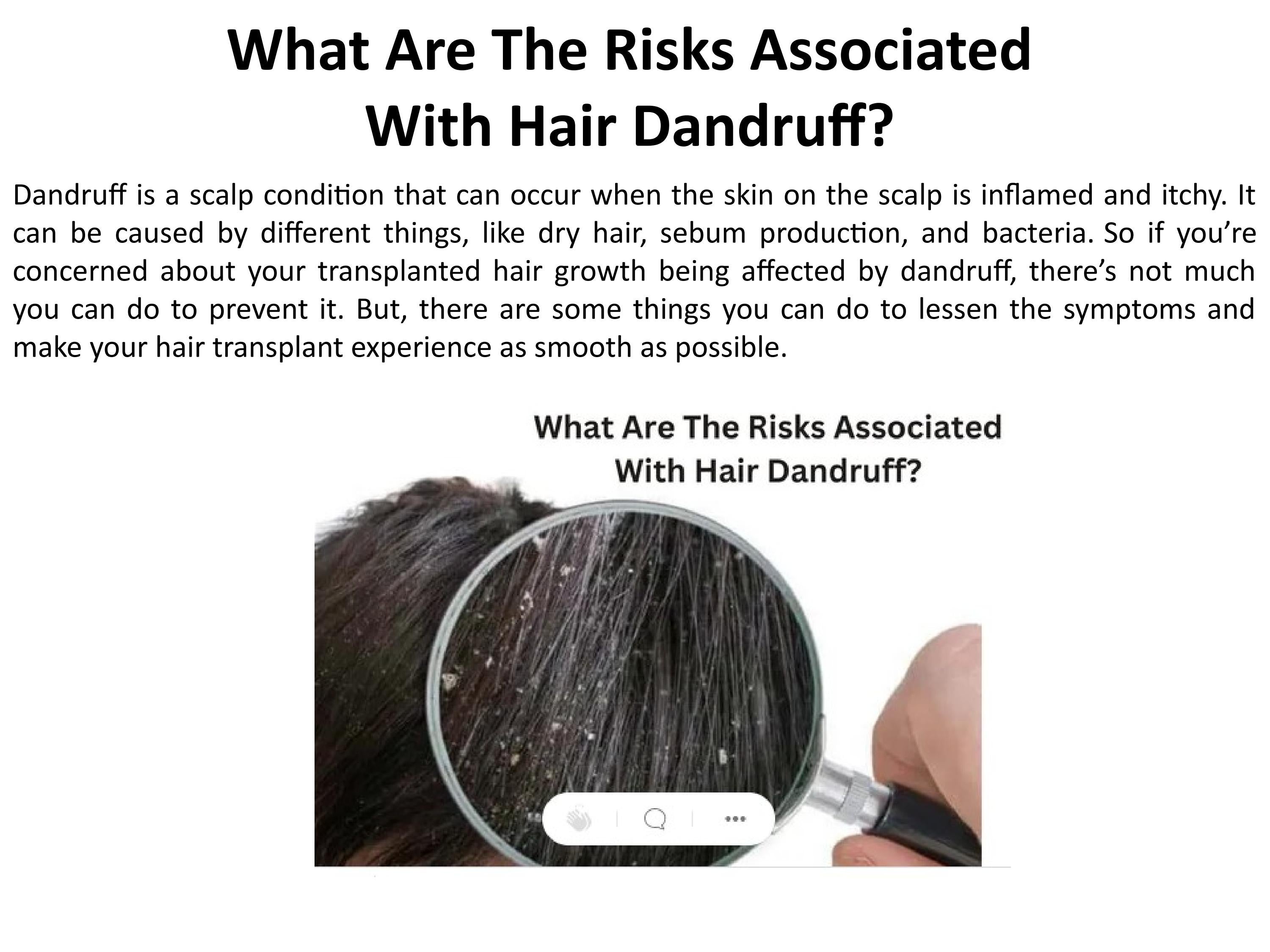 What Are the Dandruff Risks? by B Vertex Care Issuu