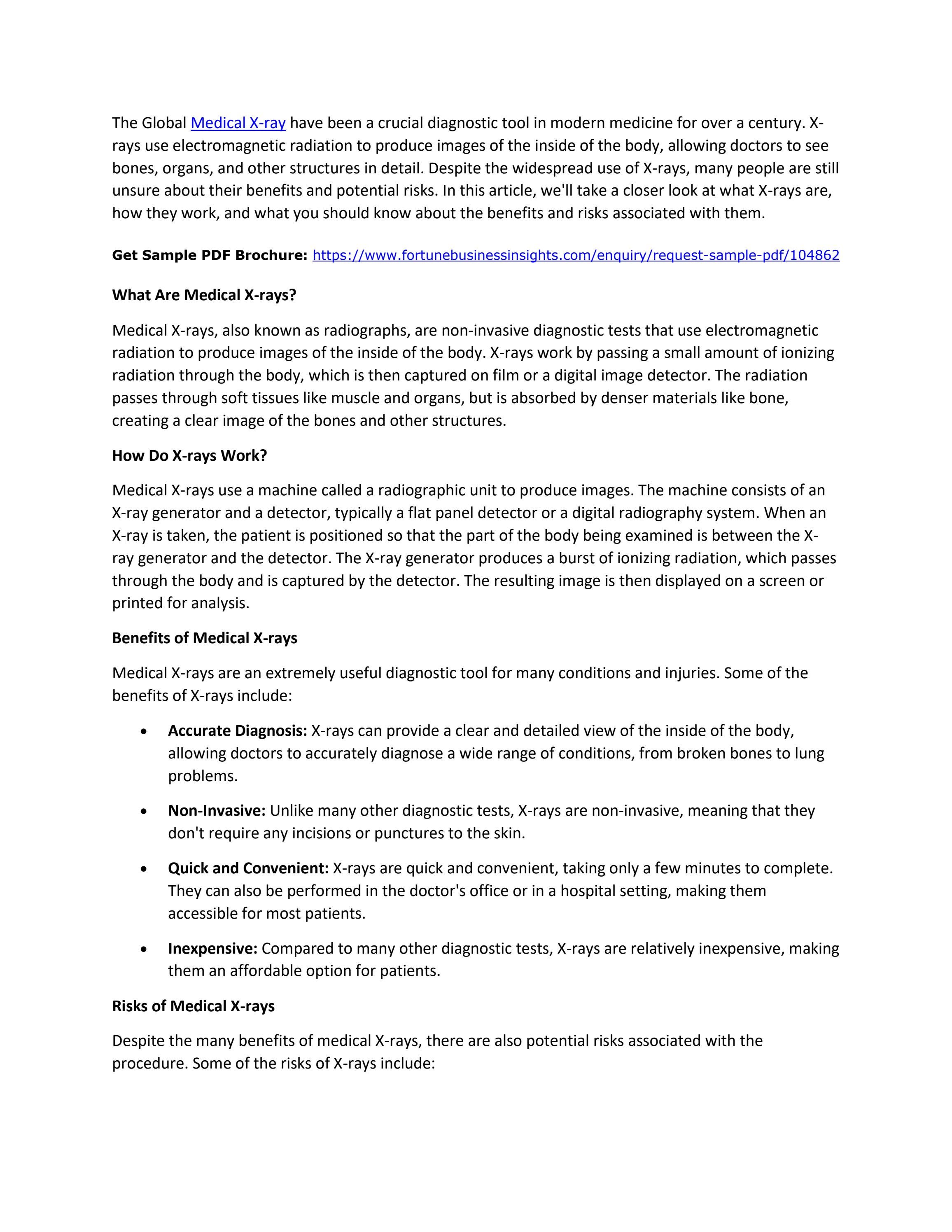 The Xray Experience An Exploration of Its Impact on Healthcare and