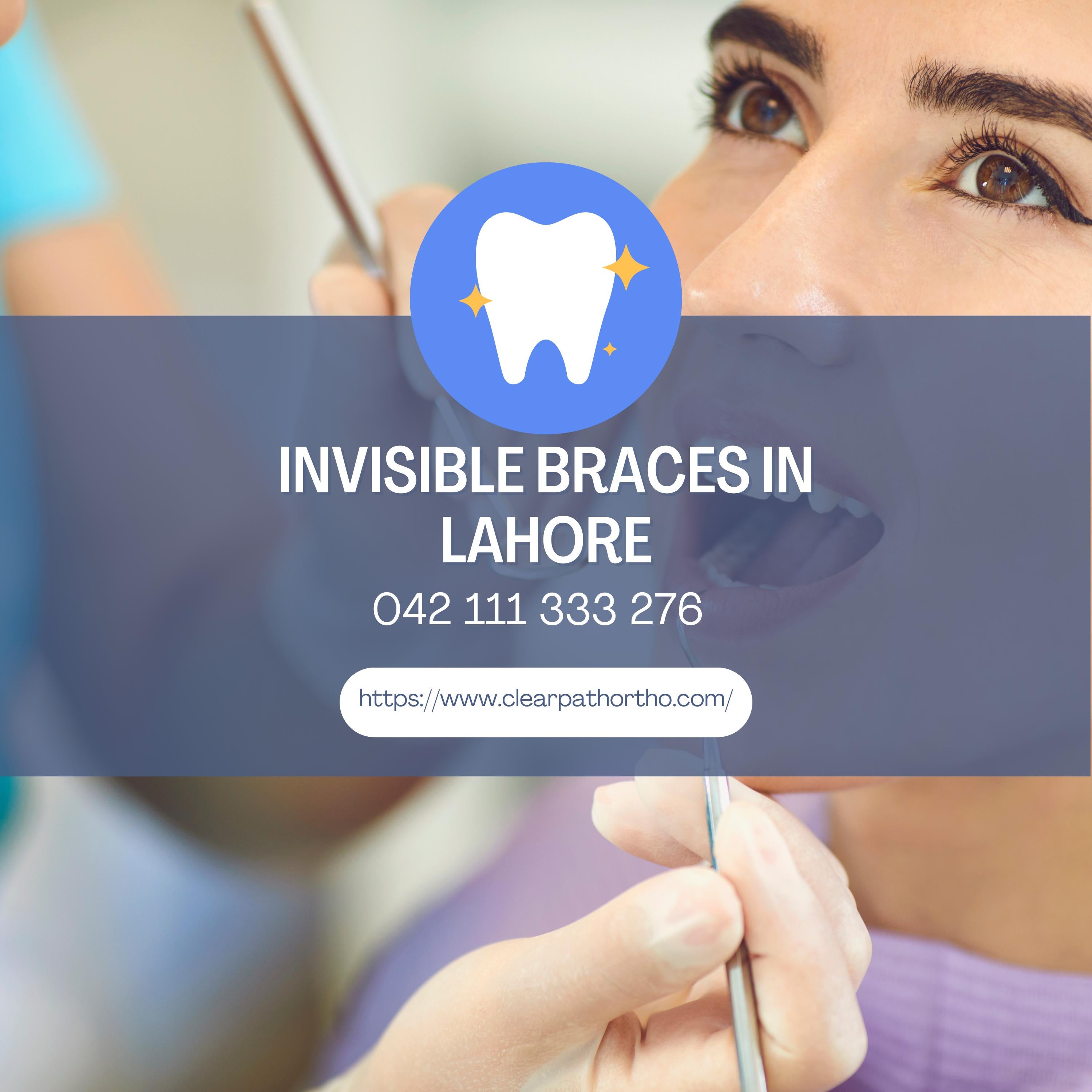 Invisible Braces Price in Pakistan by ClearPath Orthodontics Issuu