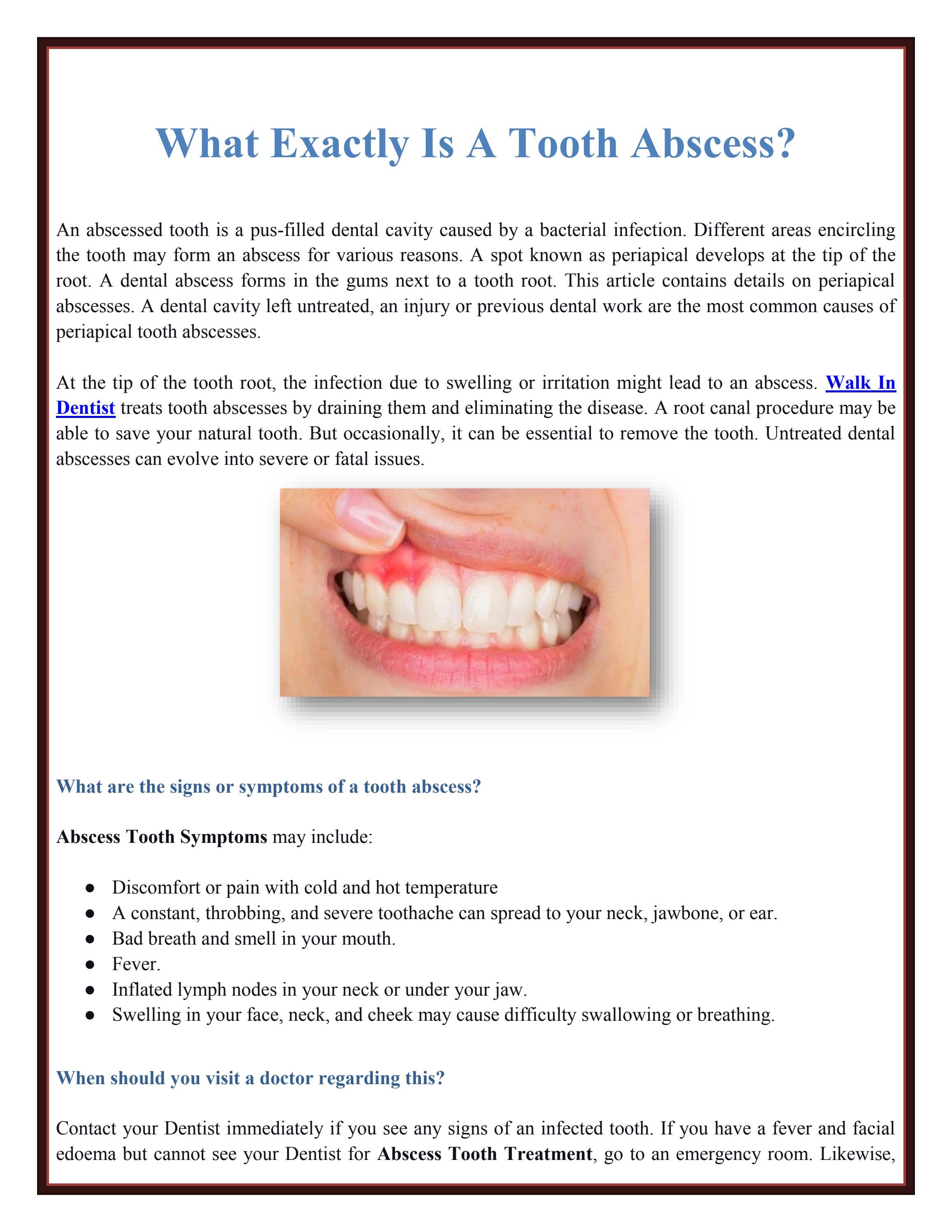 What Exactly Is A Tooth Abscess? by Emergency Dentistinhouston - Issuu