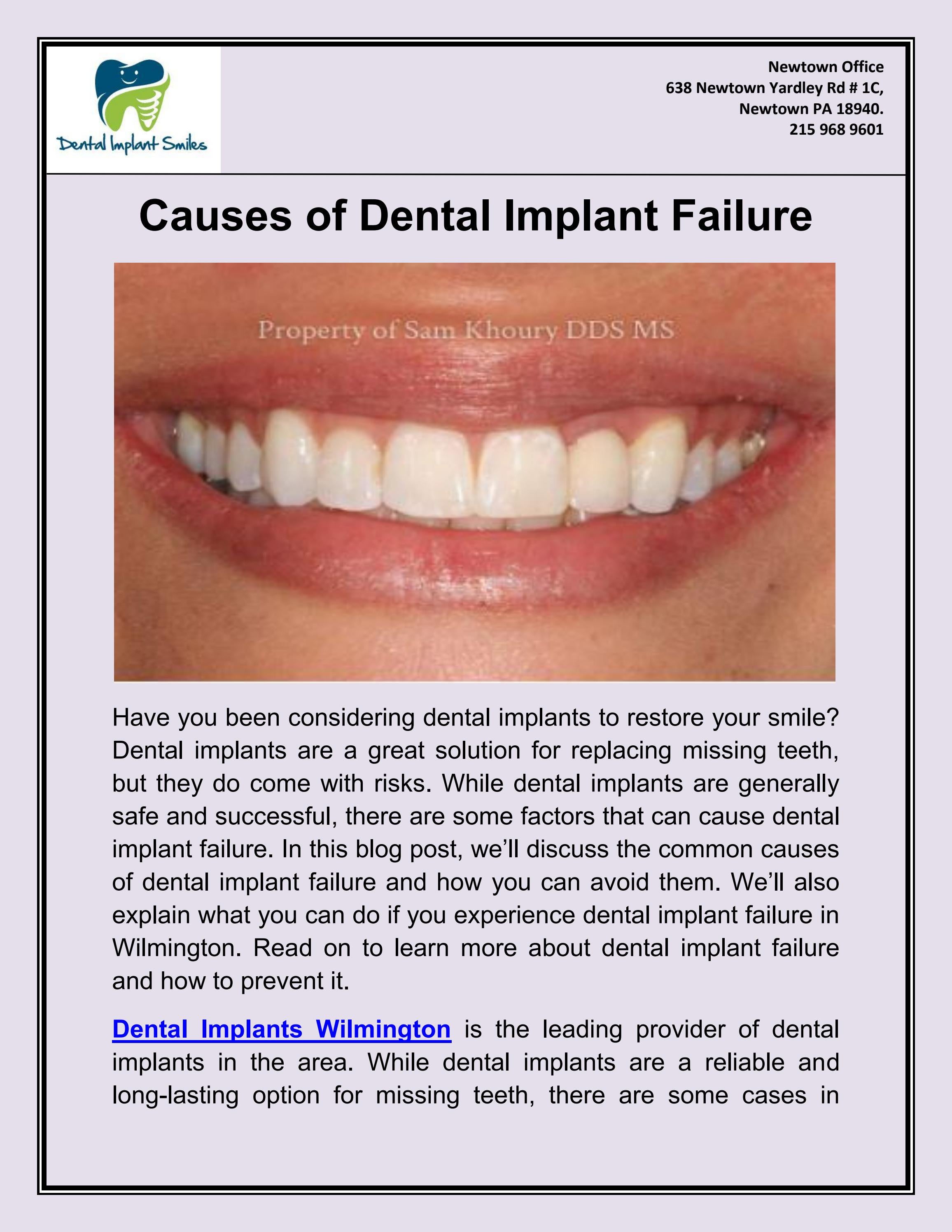 Causes of Dental Implant Failure by Dr Sam Khoury - Issuu