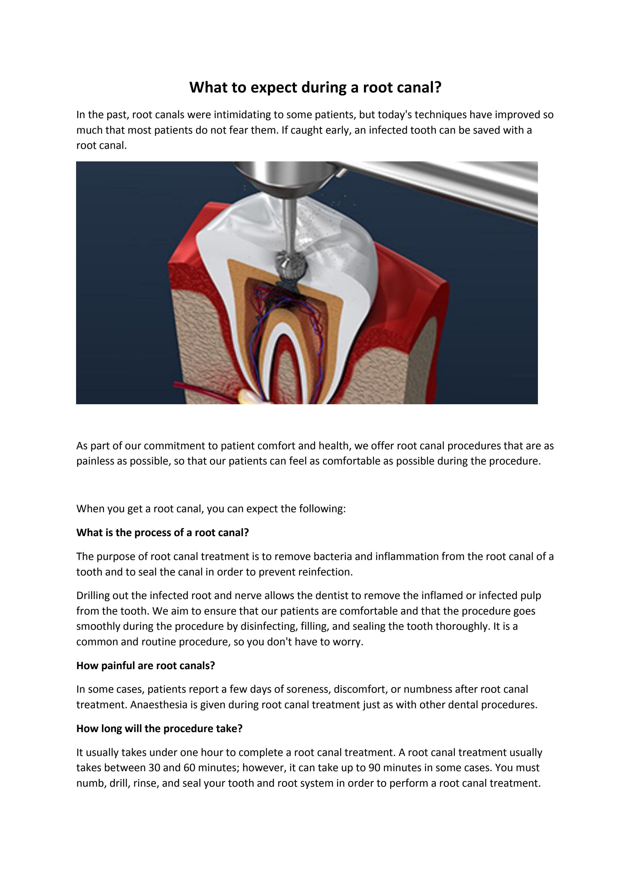 What to expect during a root canal? by Soothing Care Dental Issuu
