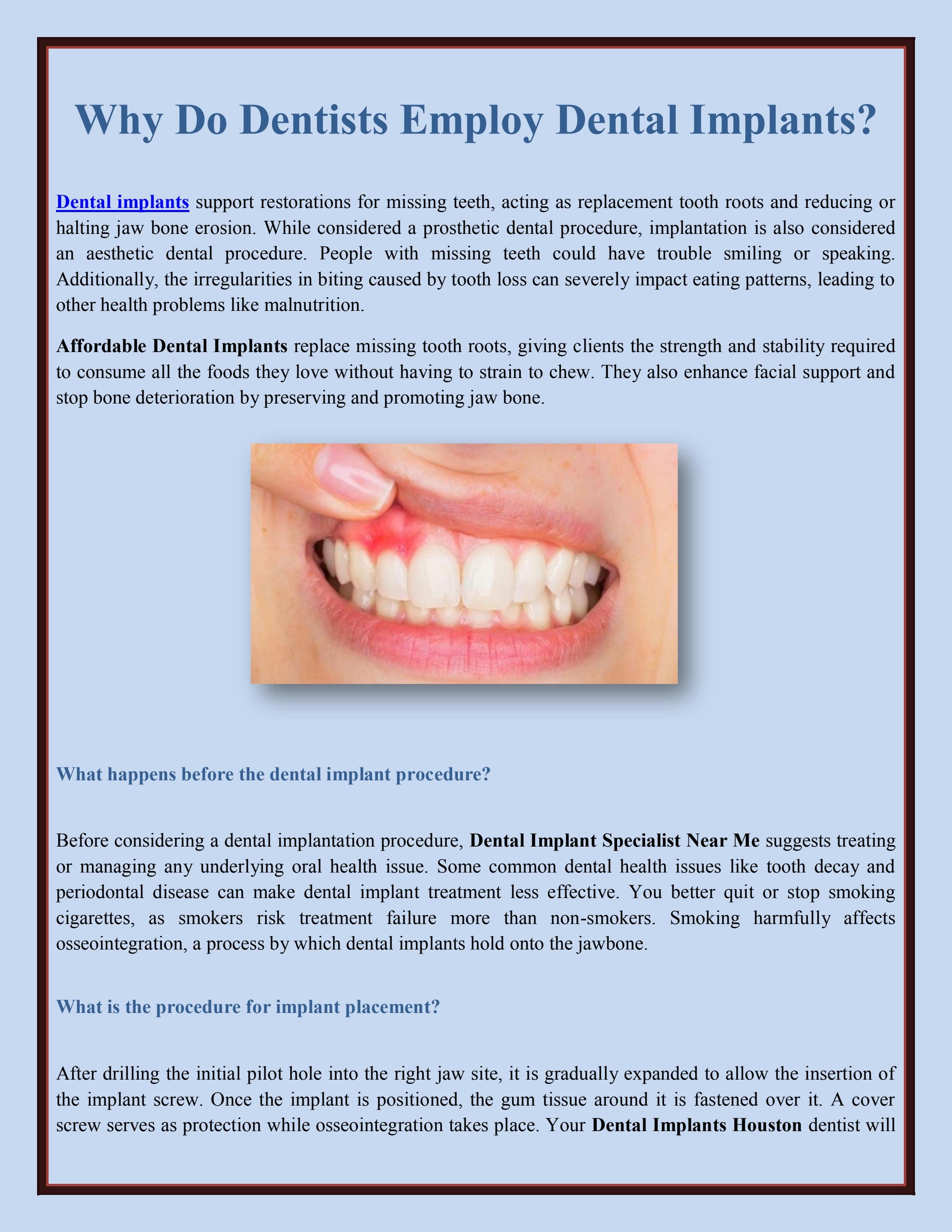 Why Do Dentists Employ Dental Implants? by Emergency Dentistinhouston