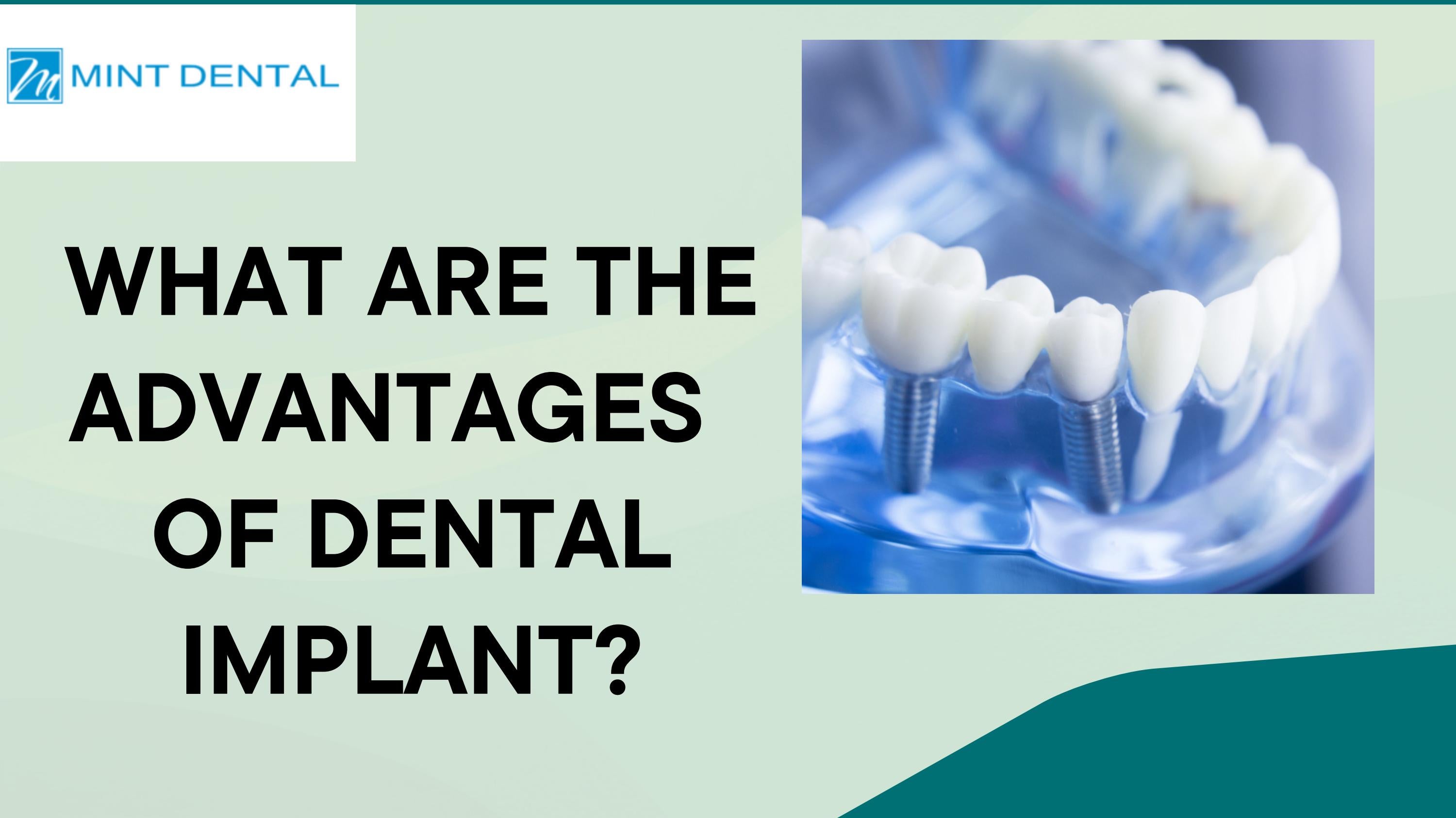 What Are the Advantages of Dental Implant? by Mint Dental Issuu