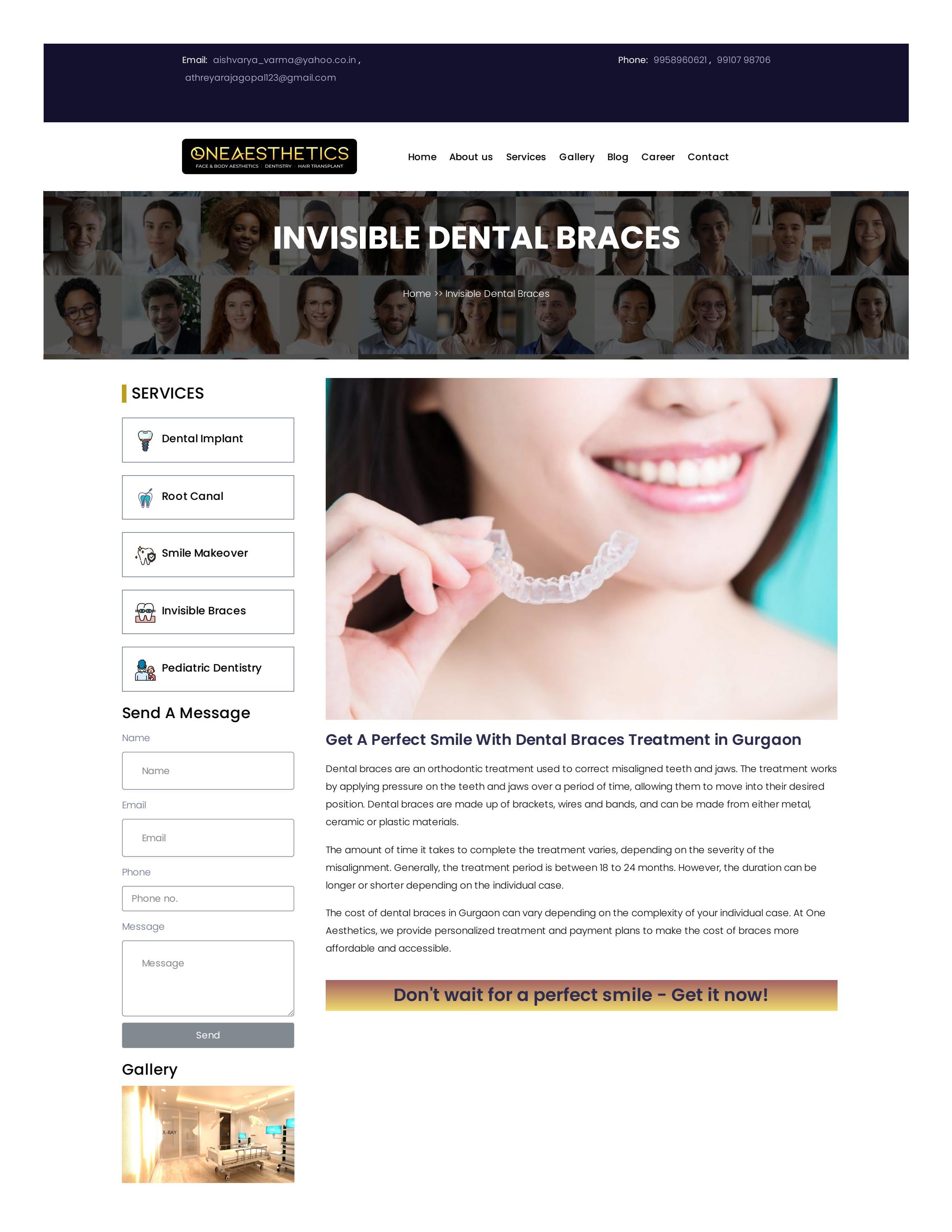 Dental Braces Treatment in Gurgaon by One aesthetics Issuu