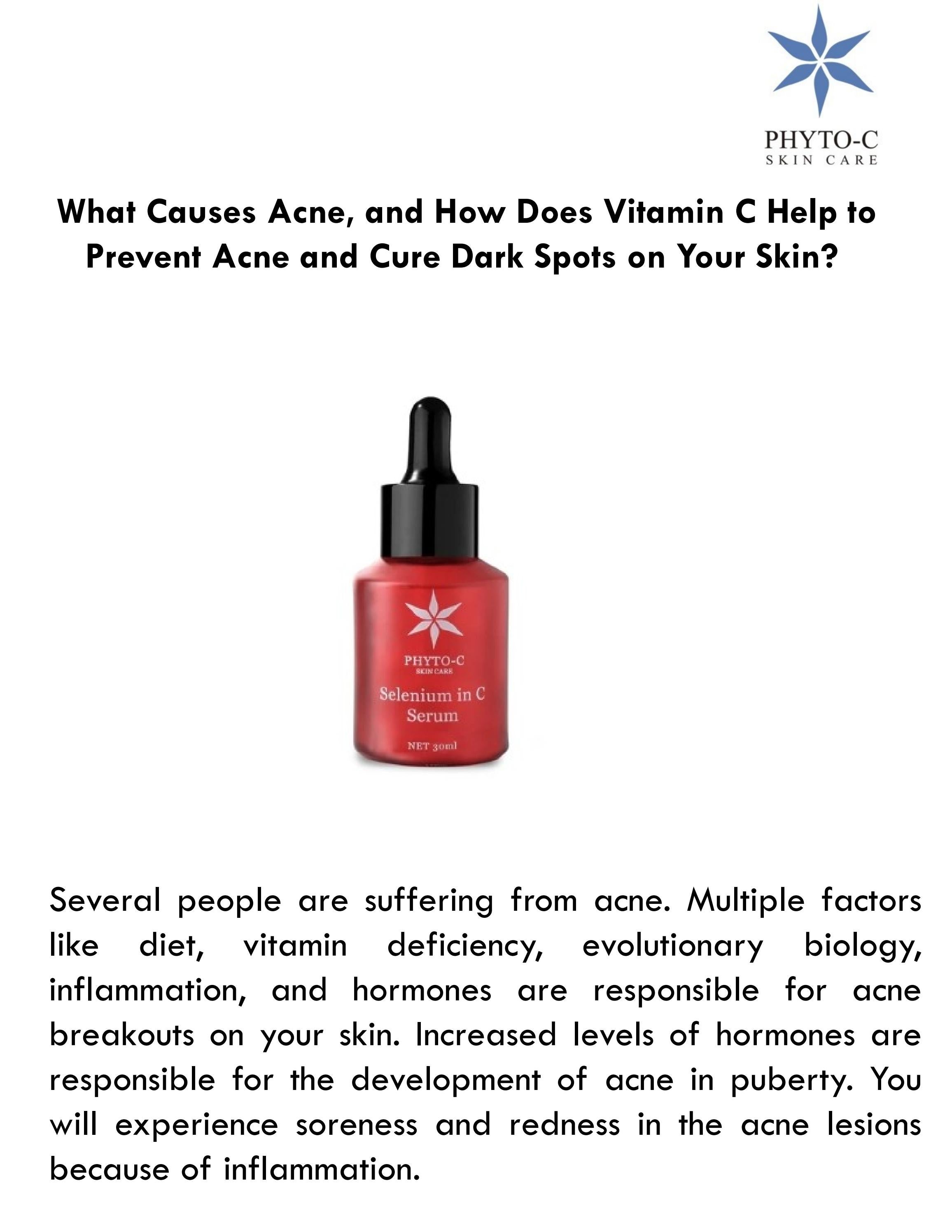 What Causes Acne, and How Does Vitamin C Help to Prevent Acne and Cure