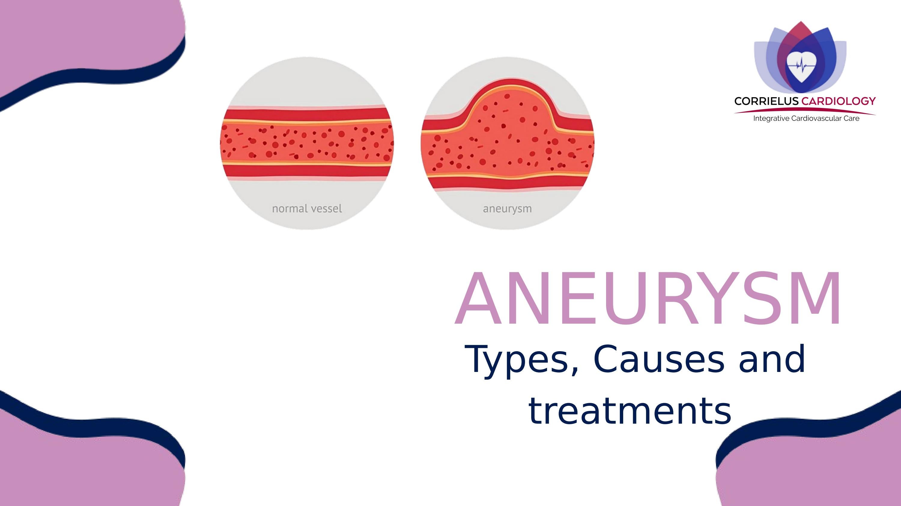 Aneurysm Types, causes & treatment by Corrieluscardiology Issuu