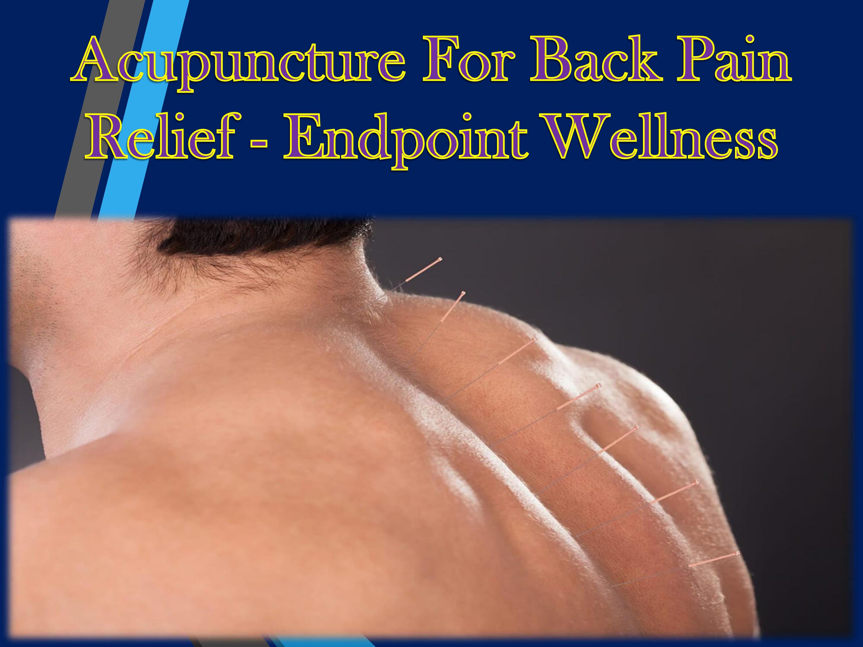 Acupuncture For Back Pain Relief Endpoint Wellness by endpointwellness Issuu