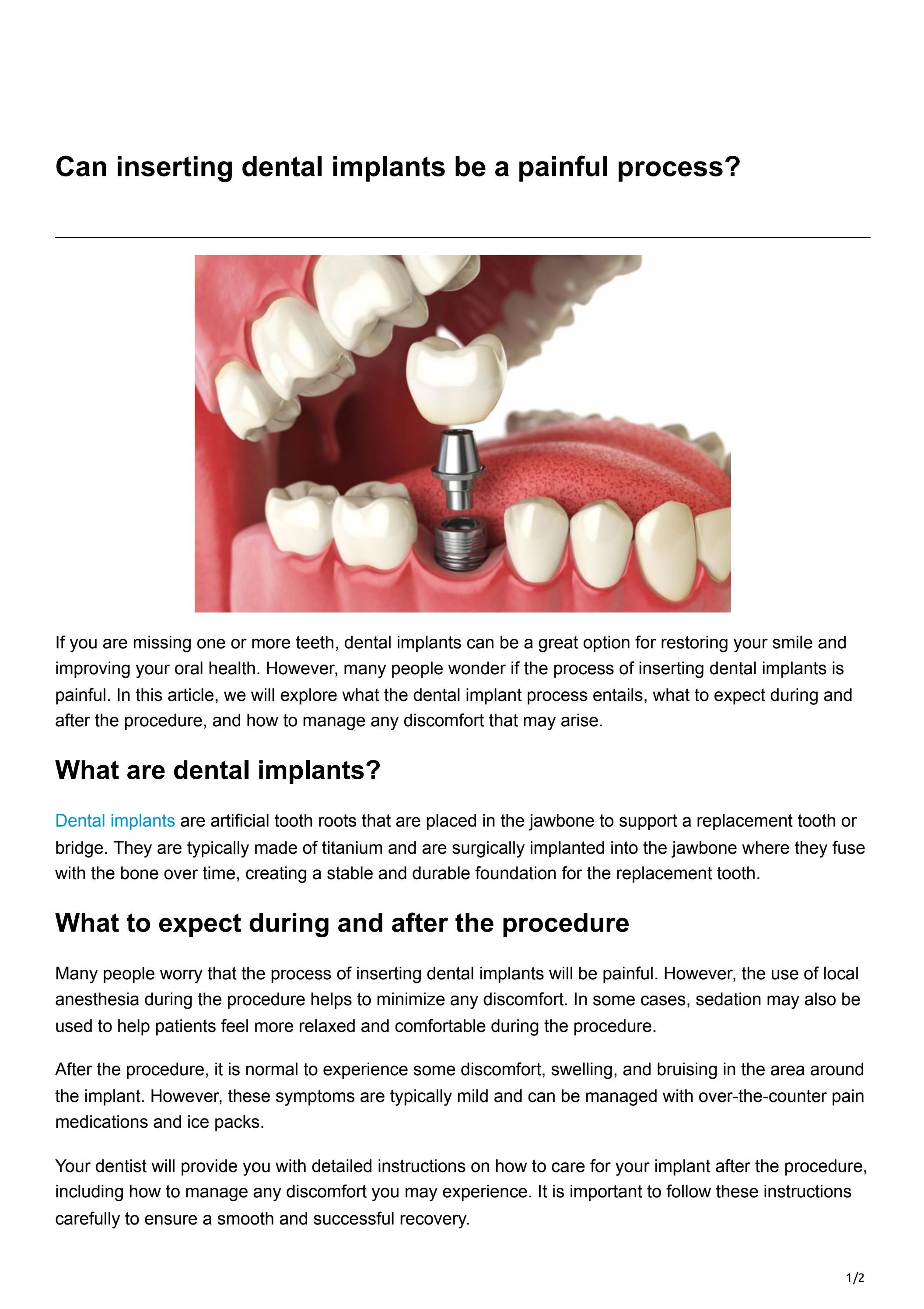 Can inserting dental implants be a painful process? by 57 Dental