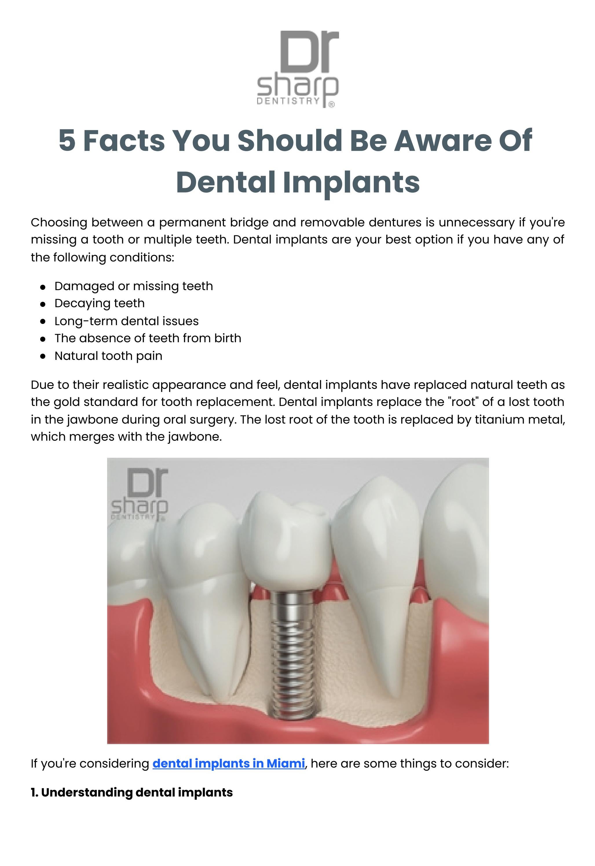 5 Facts You Should Be Aware Of Dental Implants by Sharp Dentistry