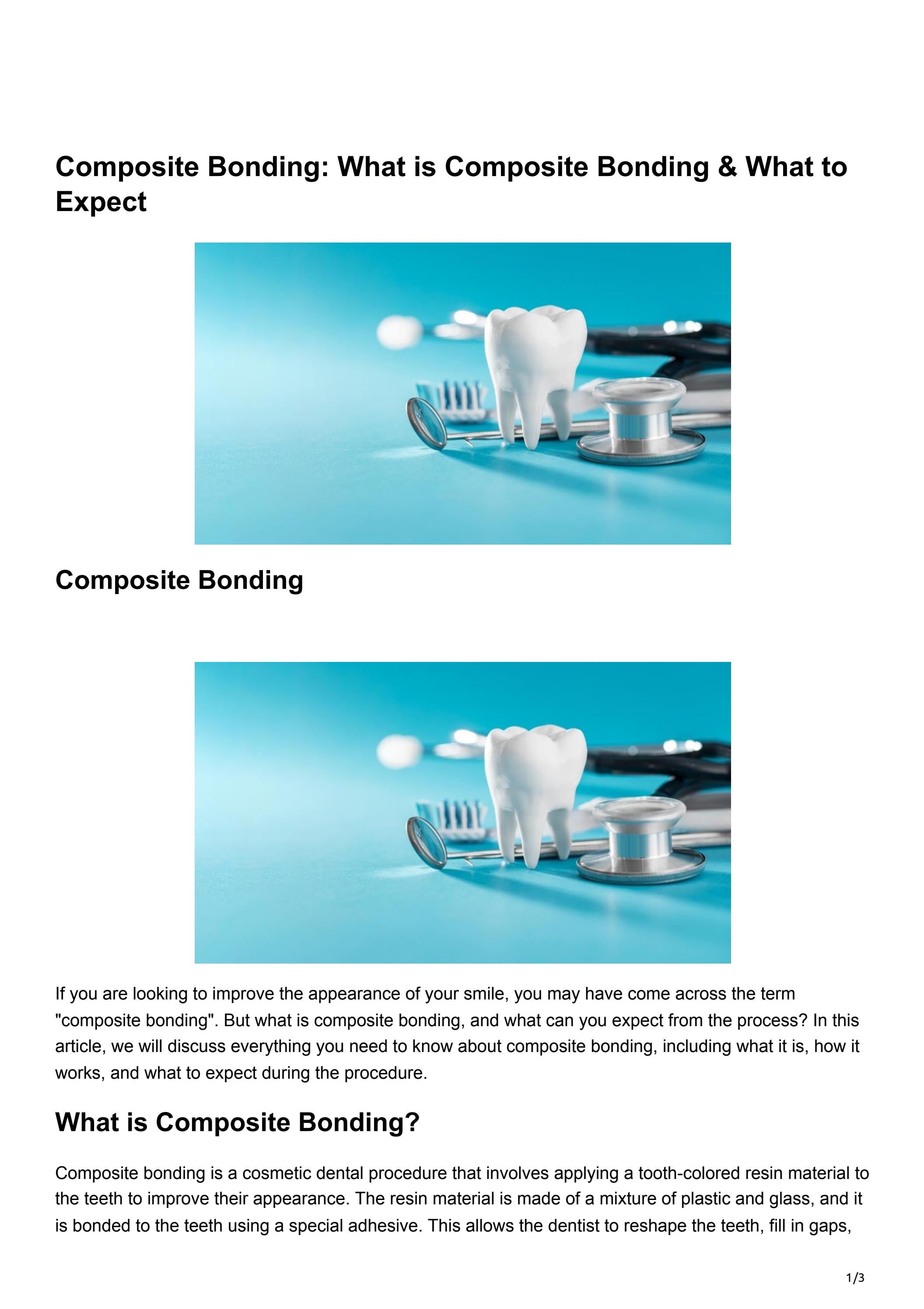 Composite Bonding: What is Composite Bonding & What to Expect by Andrew ...